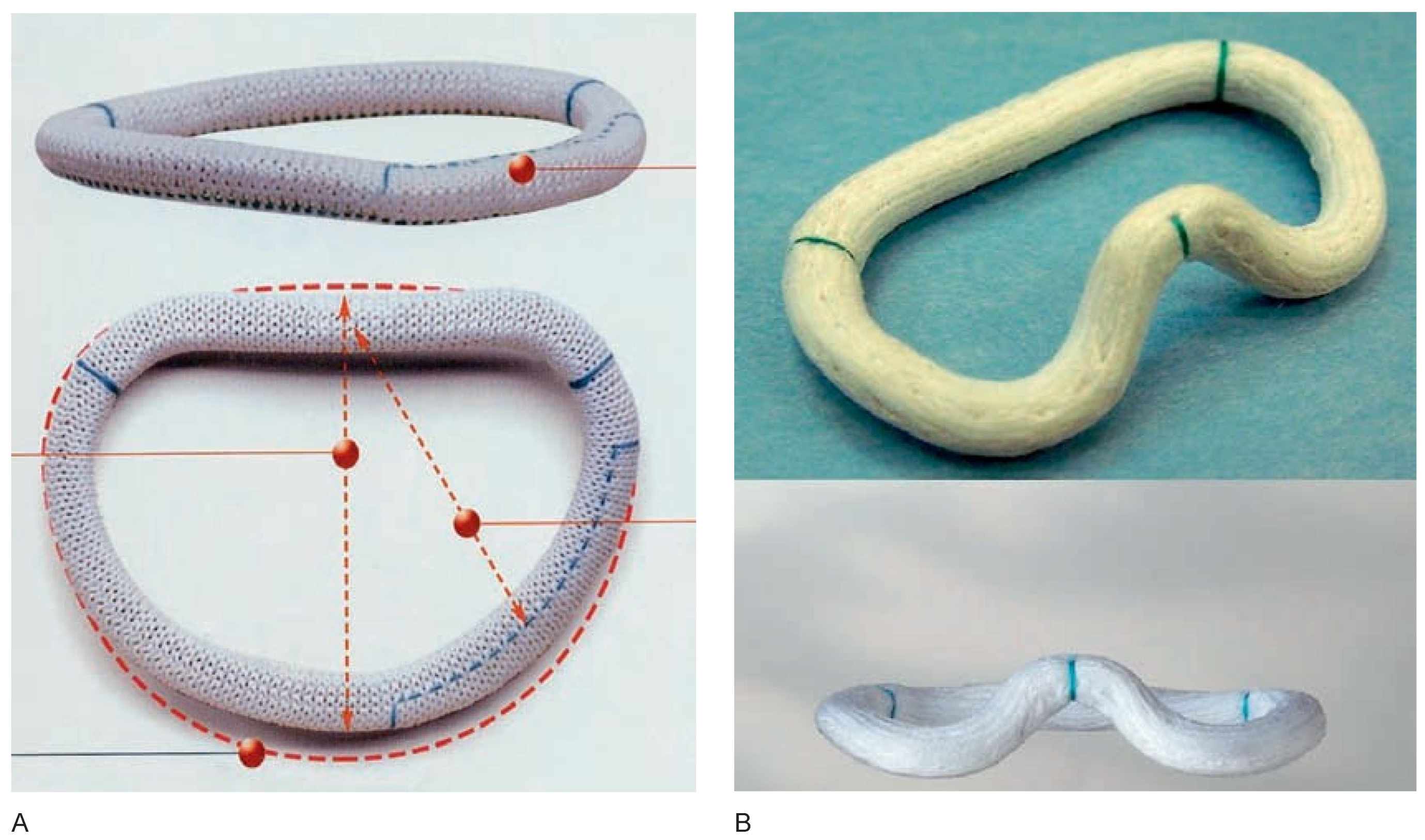 Cardiovascmed 10 00271 g004