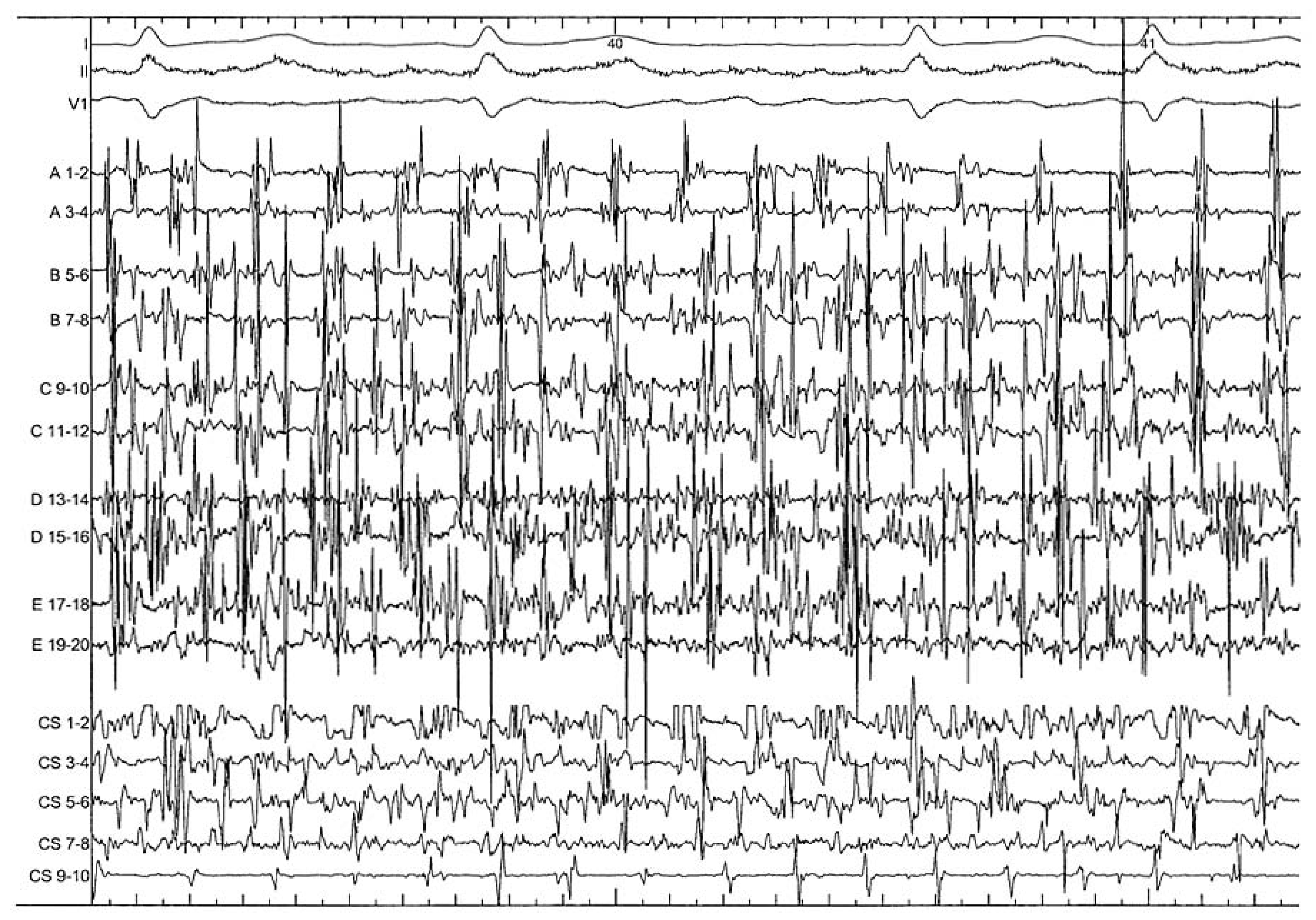 Cardiovascmed 11 00039 g001 Cardiovascmed 11 00039 g001