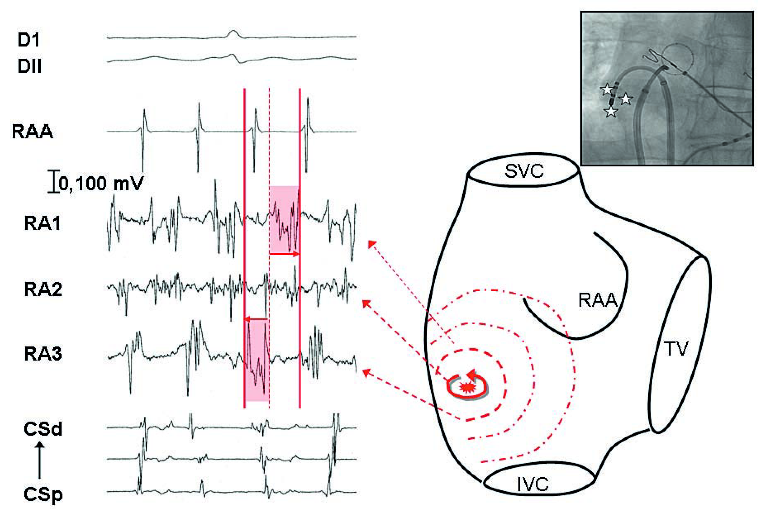 Cardiovascmed 11 00039 g004 Cardiovascmed 11 00039 g004