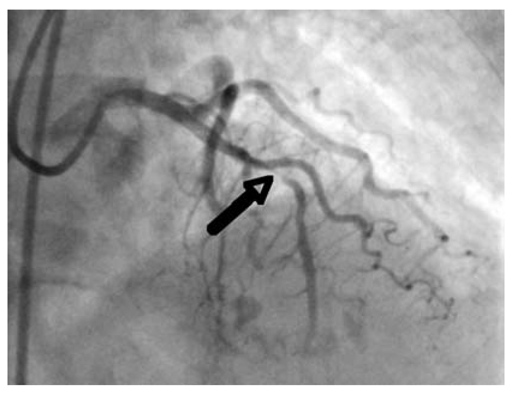 Cardiovascmed 11 00097 g001