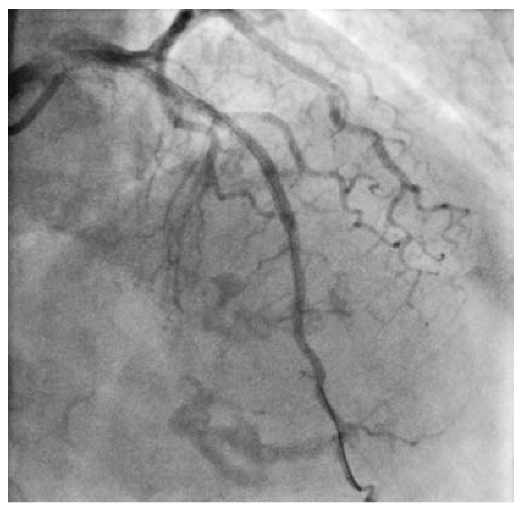 Cardiovascmed 11 00097 g002