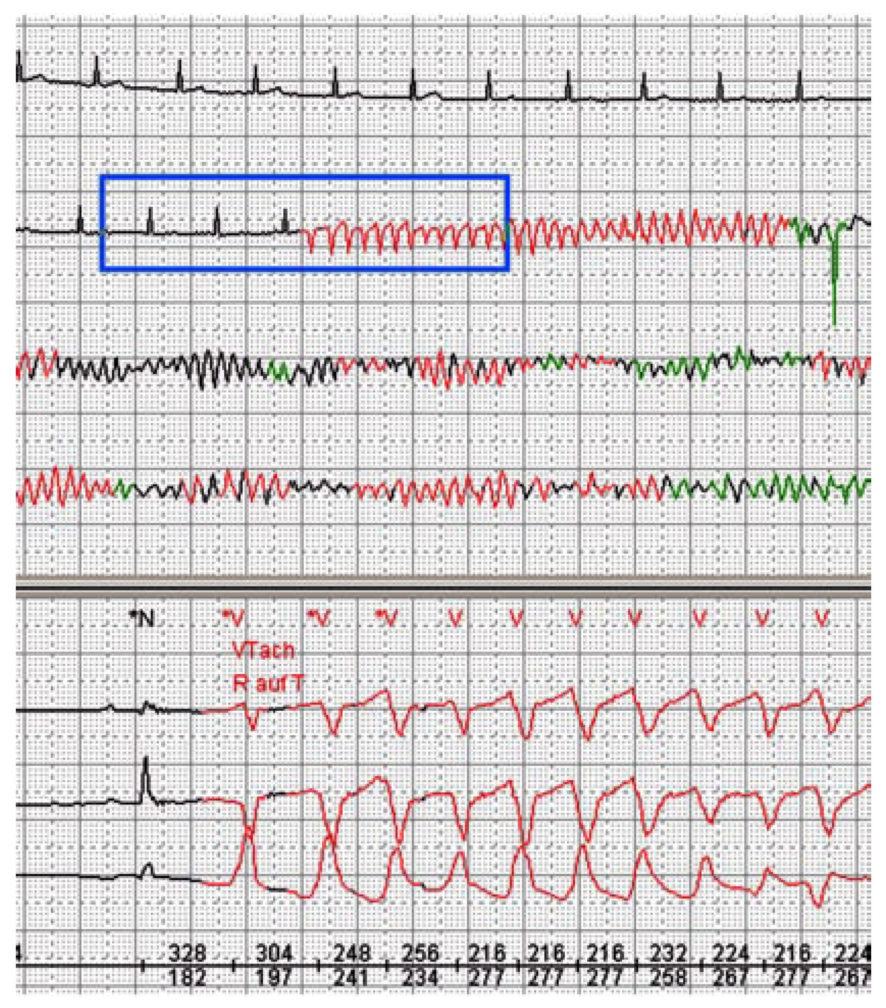 Cardiovascmed 11 00097 g003