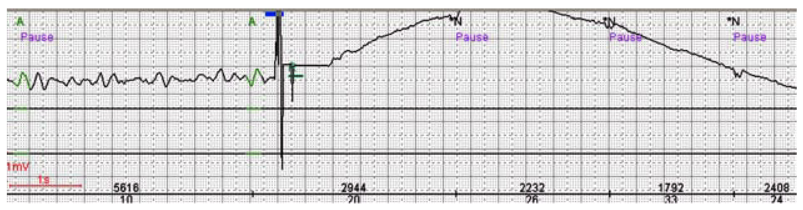 Cardiovascmed 11 00097 g004