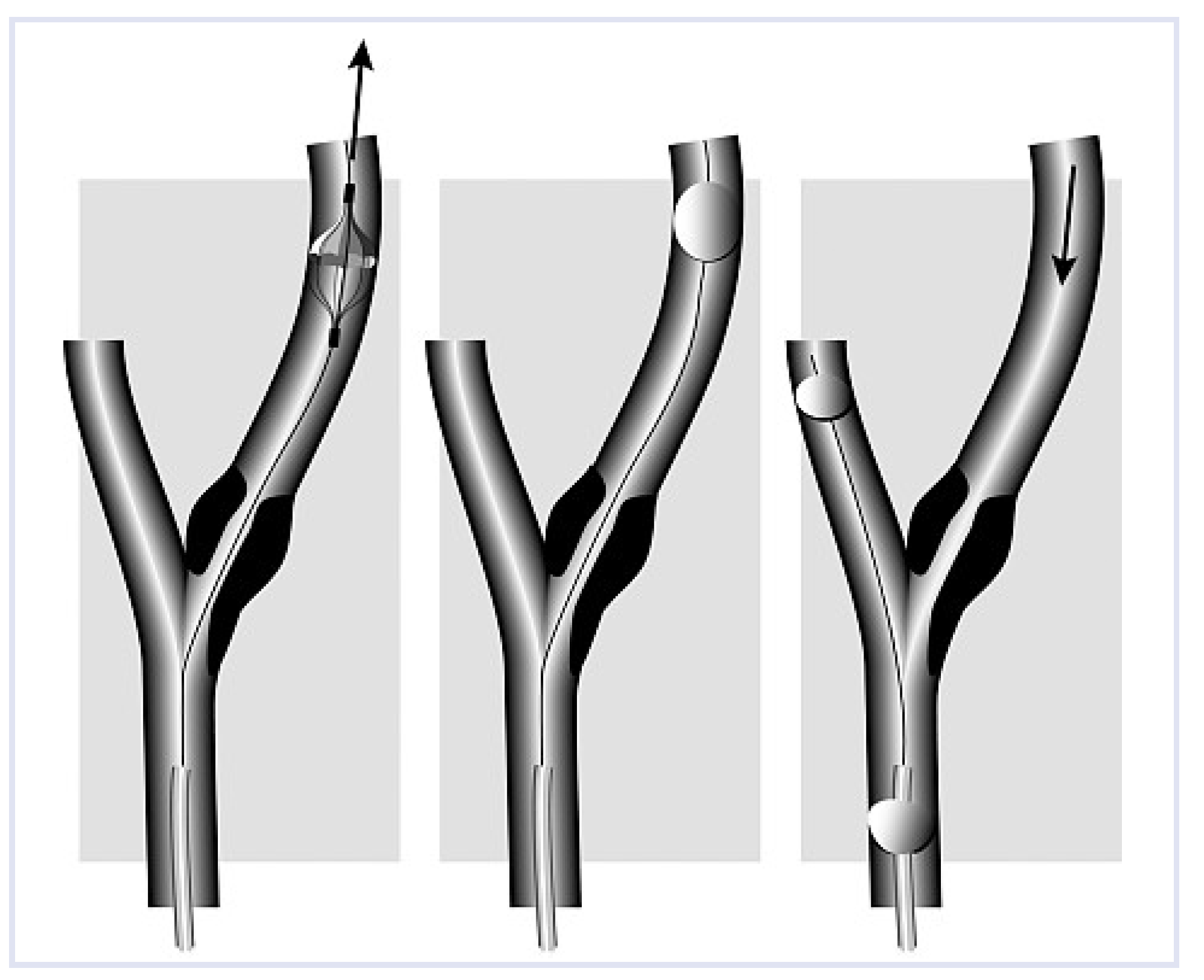 Cardiovascmed 12 00045 g001