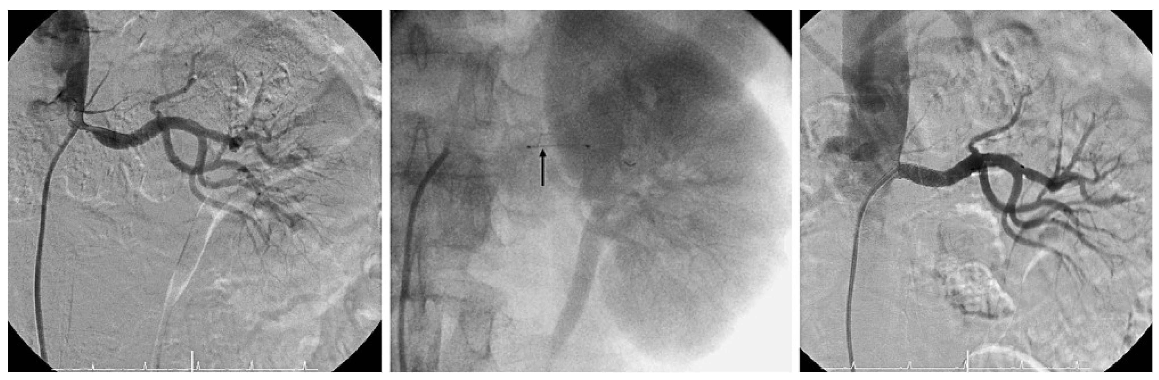 Cardiovascmed 12 00045 g006