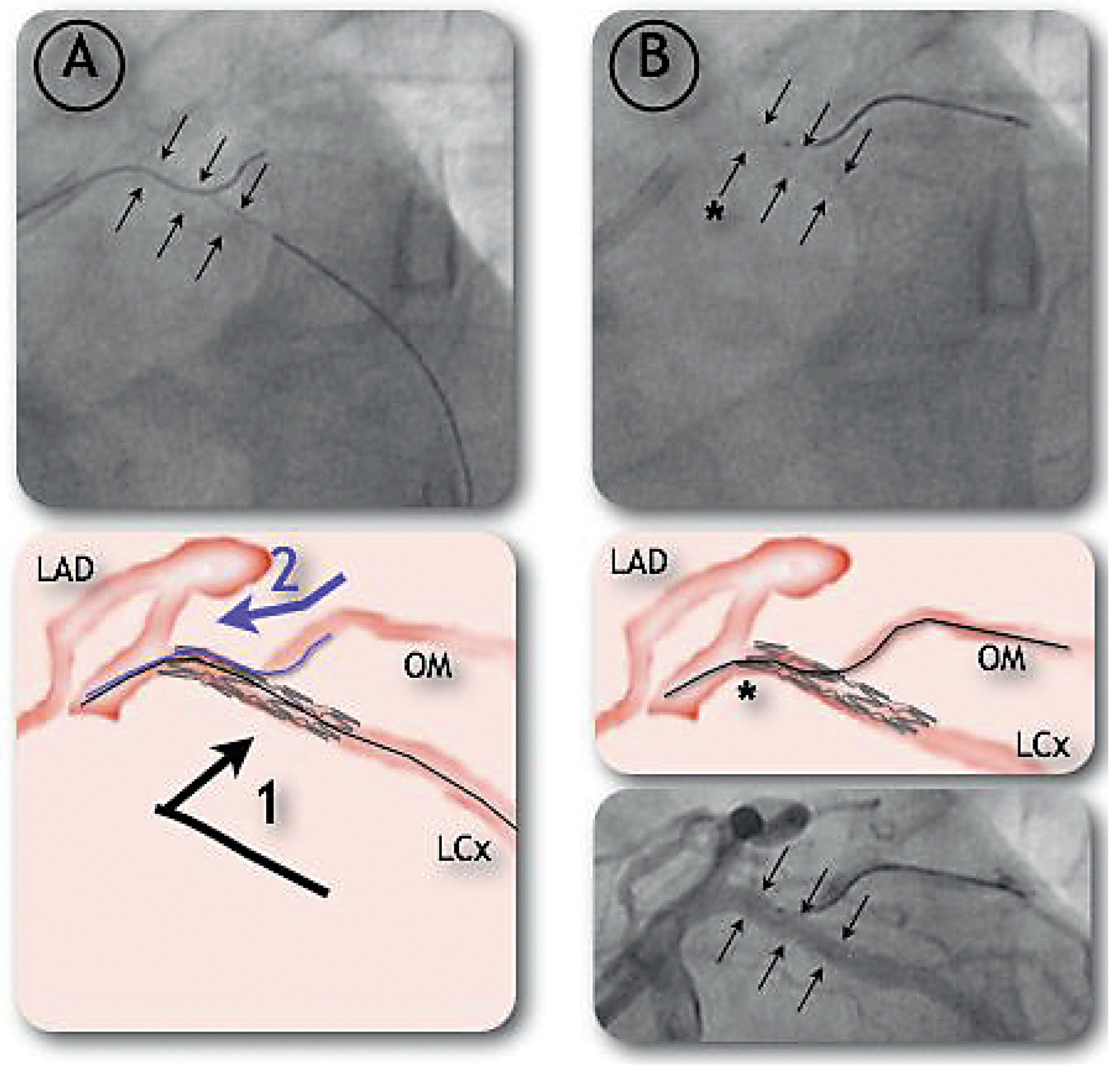 Cardiovascmed 12 00053 g002