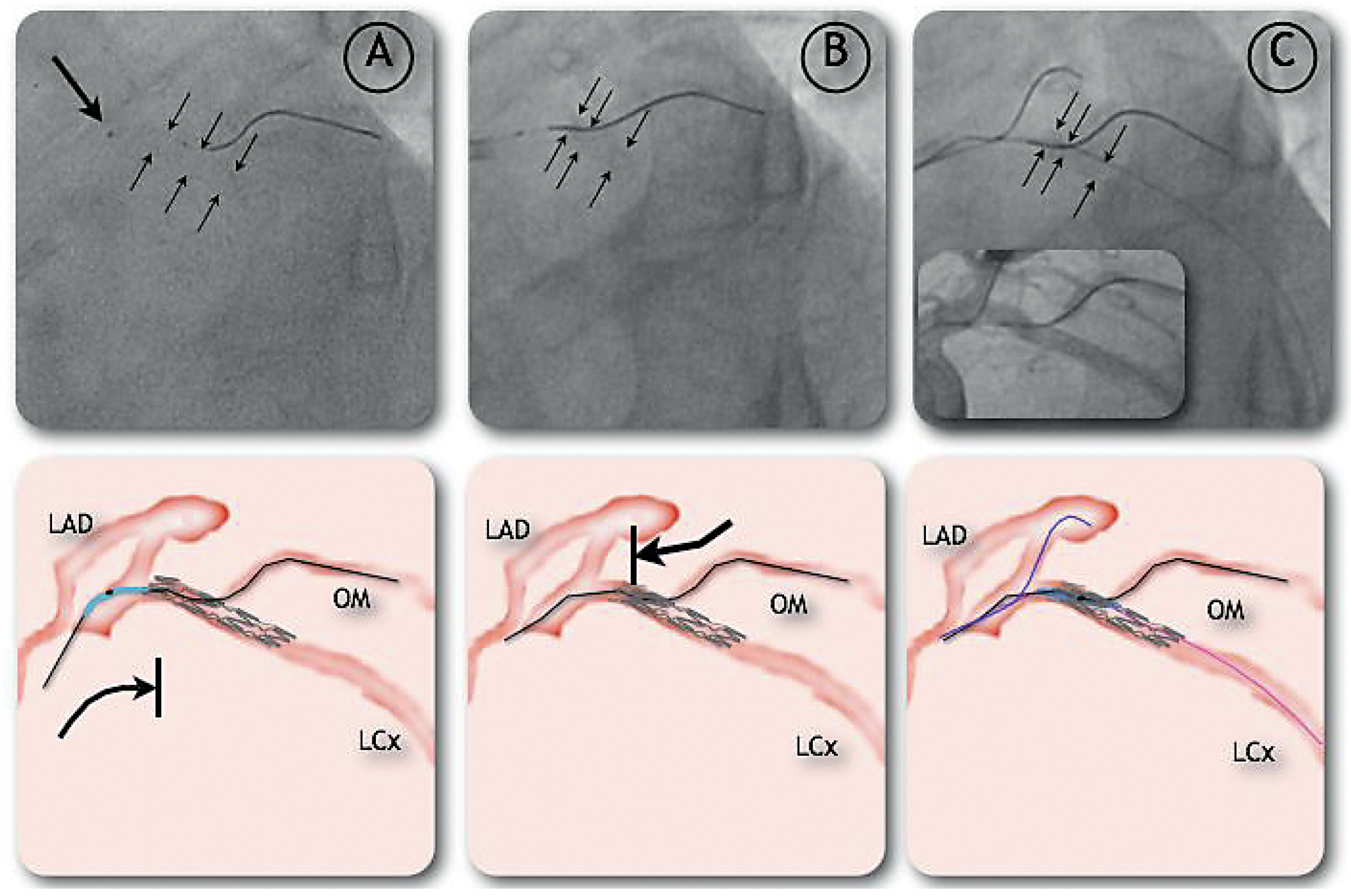 Cardiovascmed 12 00053 g003