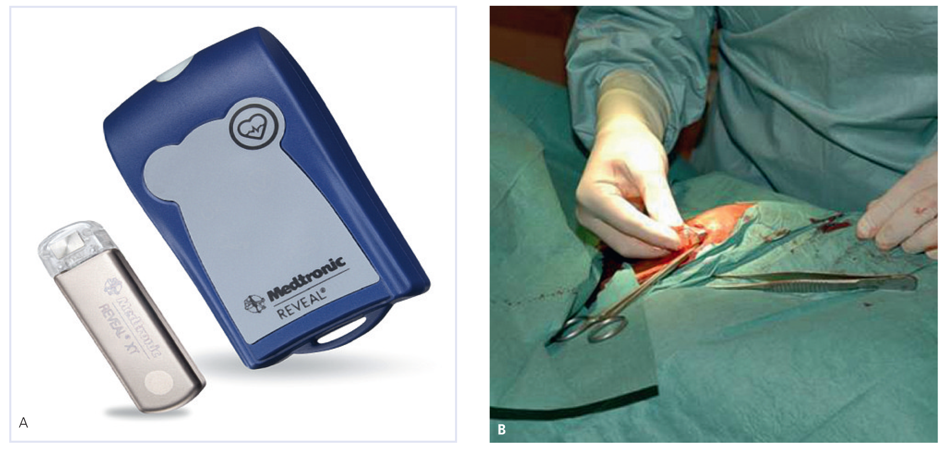 Cardiovascmed 12 00085 g001