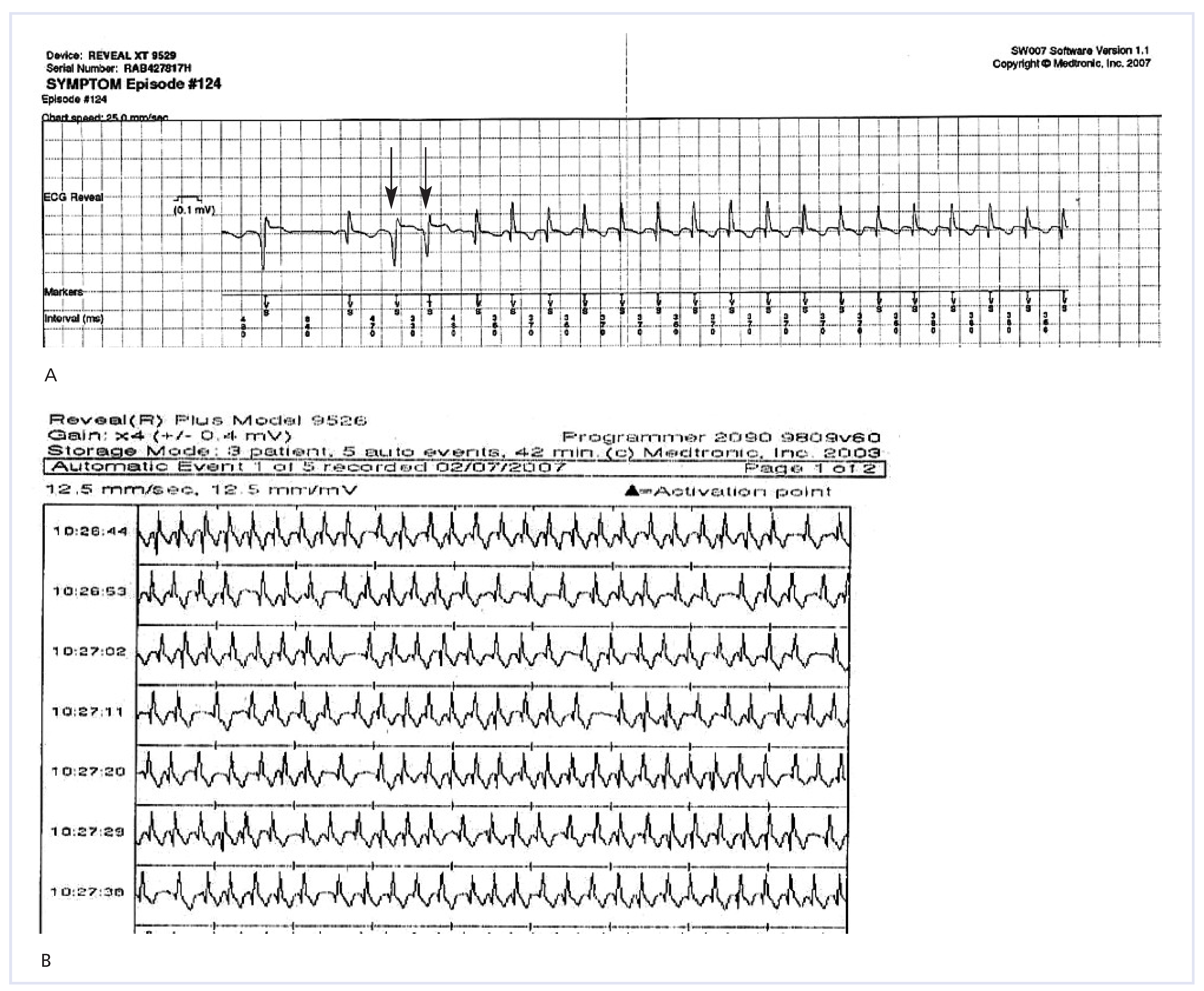 Cardiovascmed 12 00085 g002