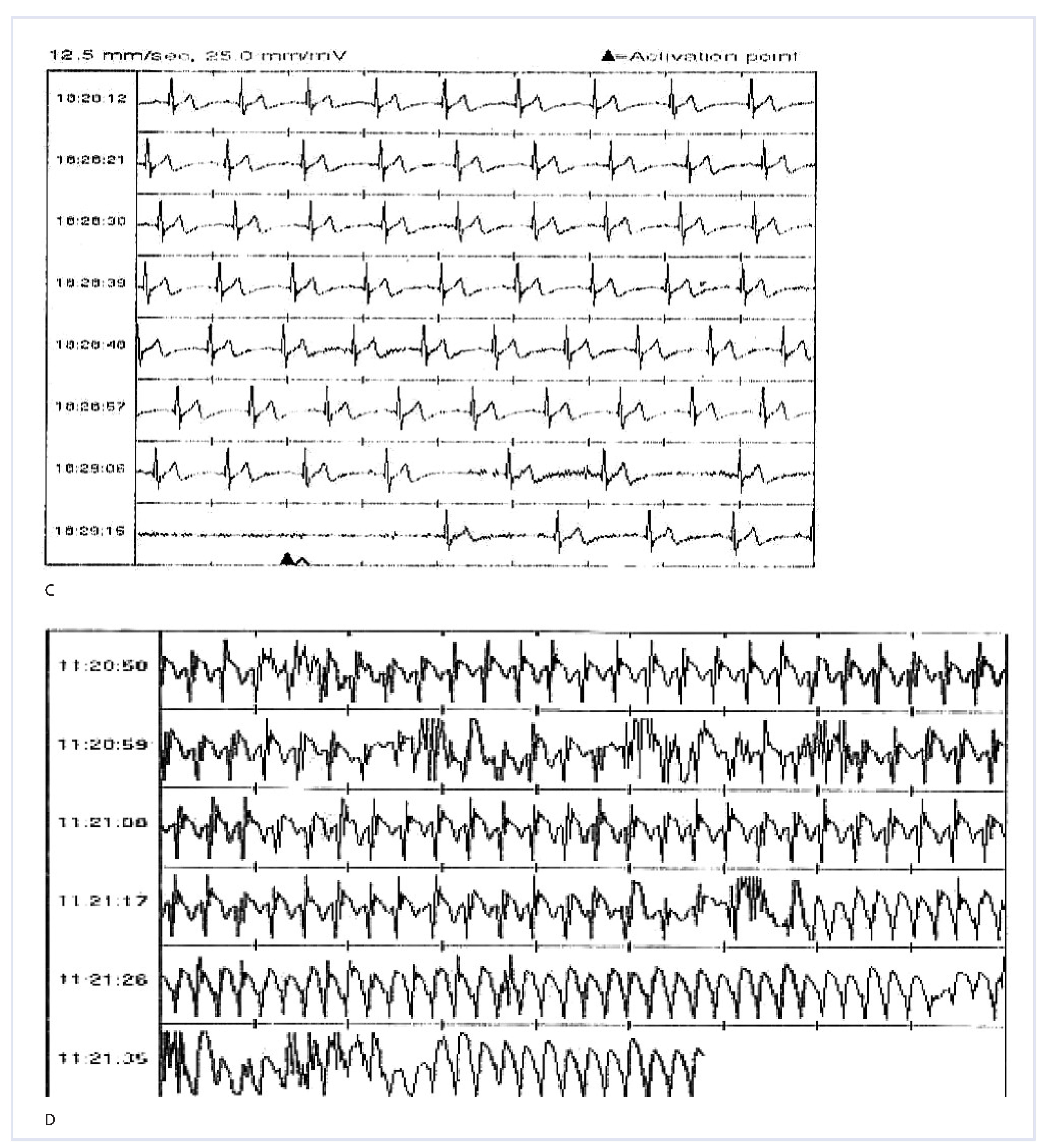 Cardiovascmed 12 00085 g003