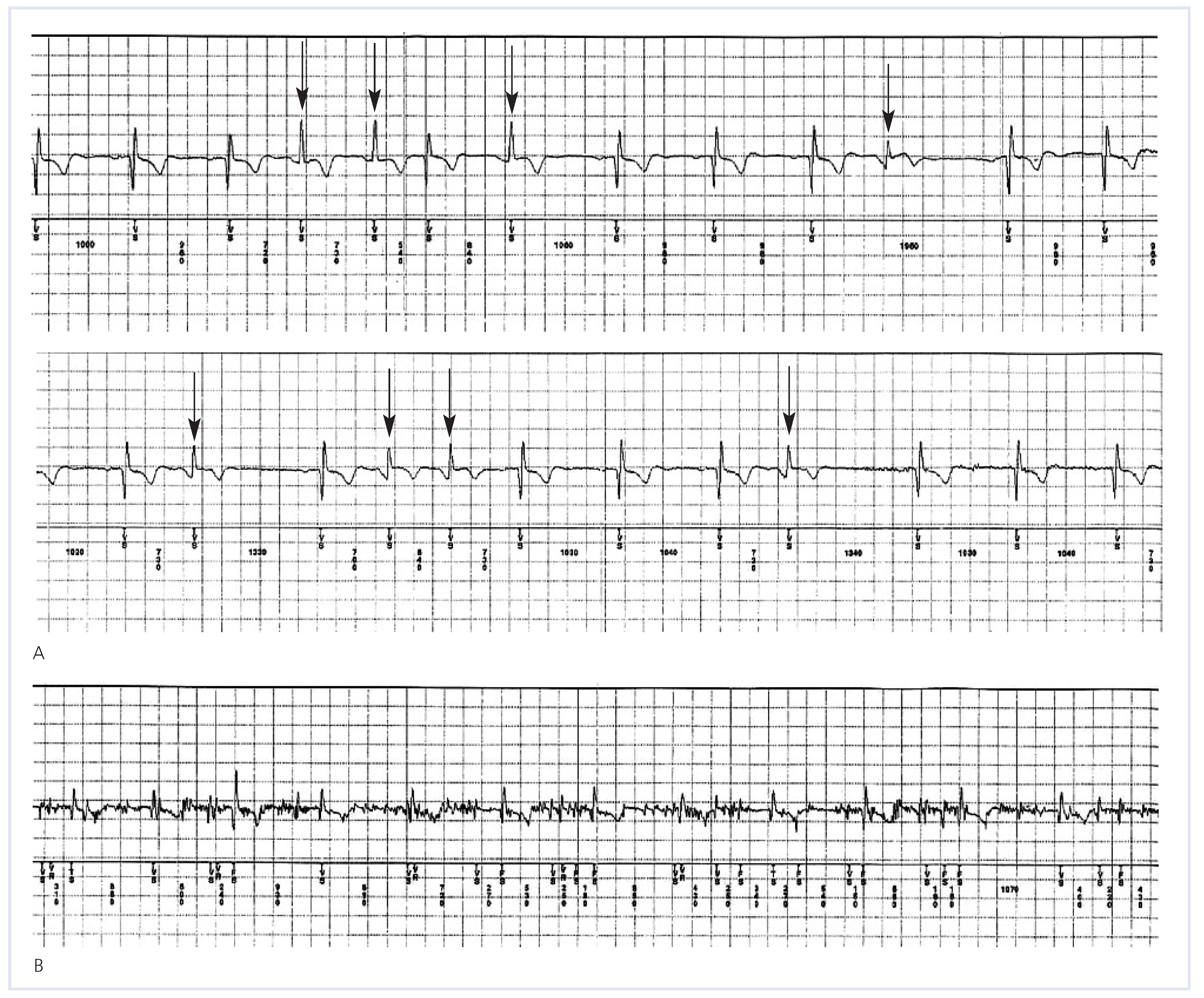 Cardiovascmed 12 00085 g004