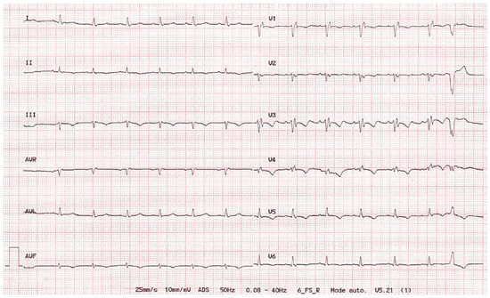 Cardiovascmed 12 00336 g001
