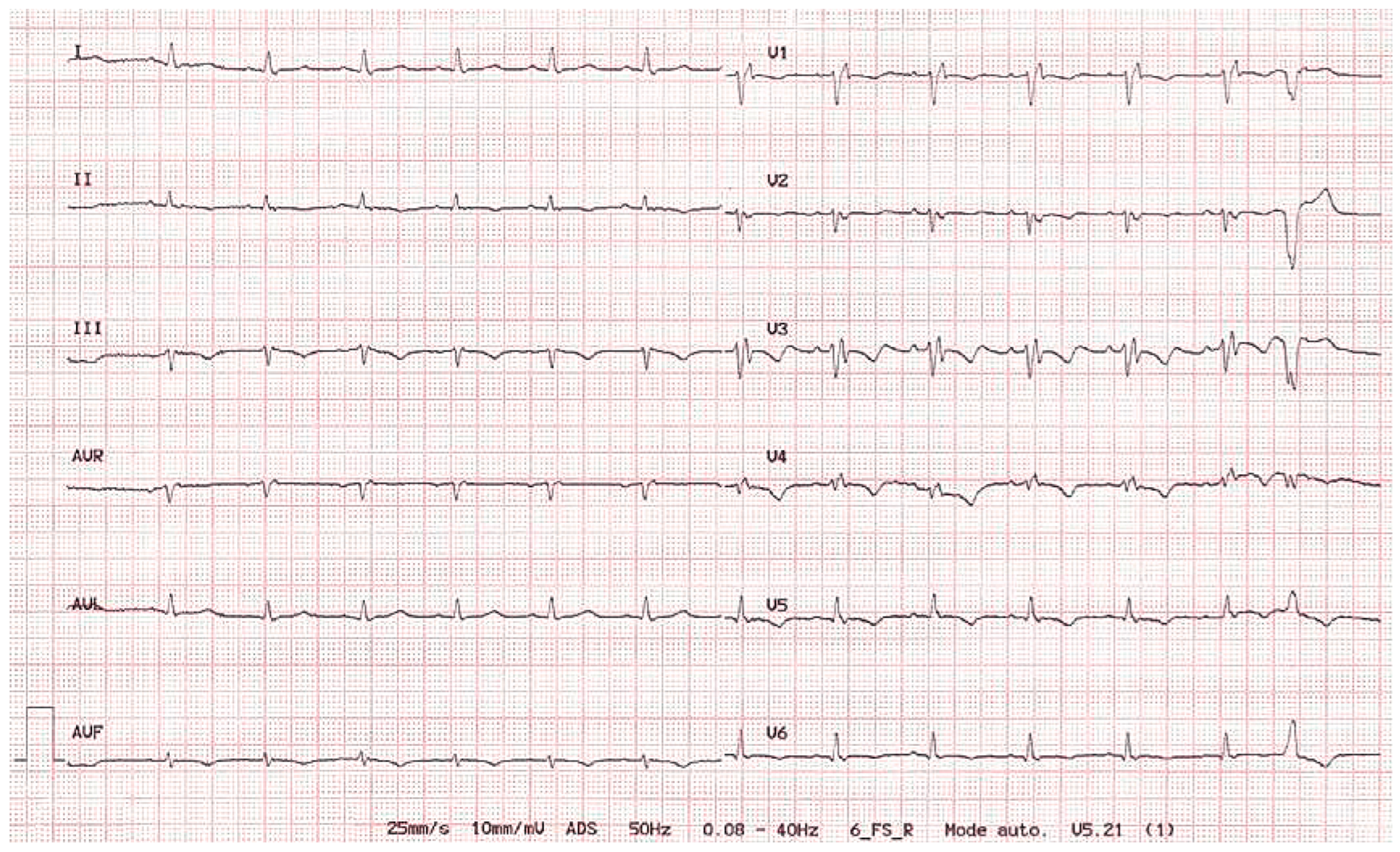 Cardiovascmed 12 00336 g001