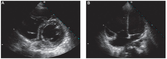 Cardiovascmed 12 00336 g002