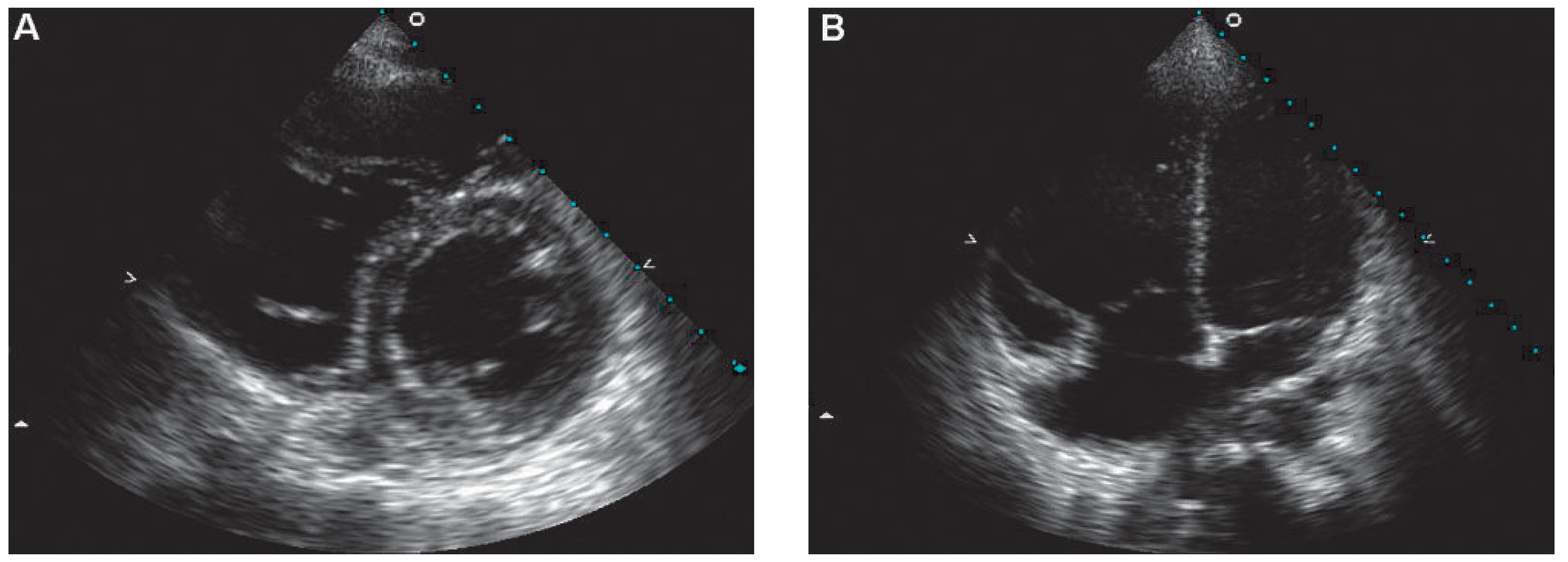 Cardiovascmed 12 00336 g002