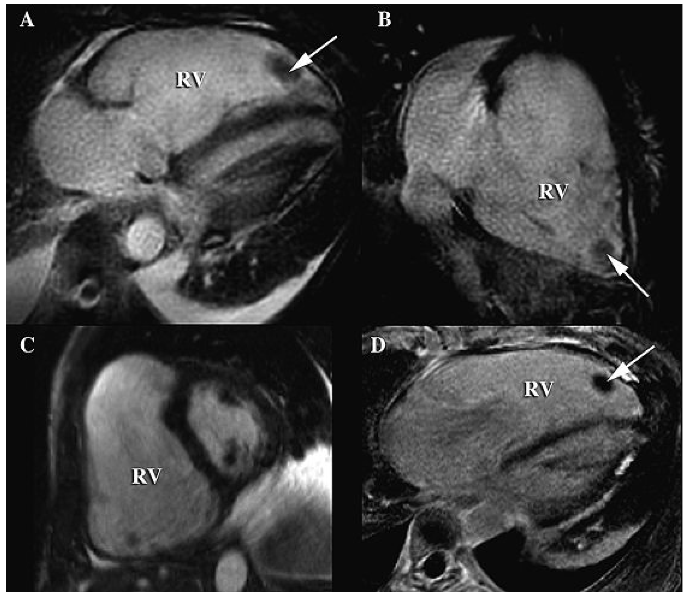 Cardiovascmed 12 00336 g003