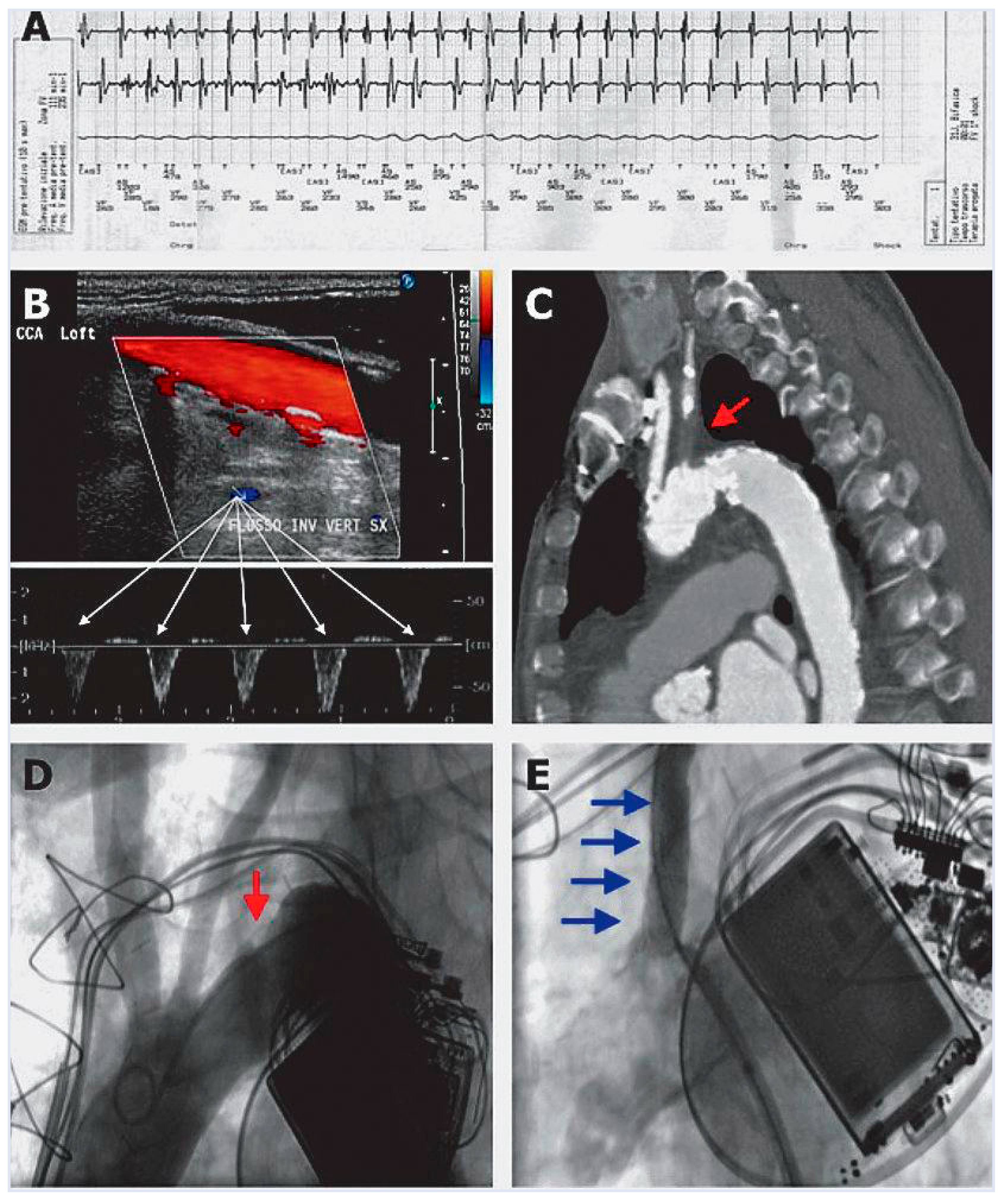 Cardiovascmed 13 00027 g001