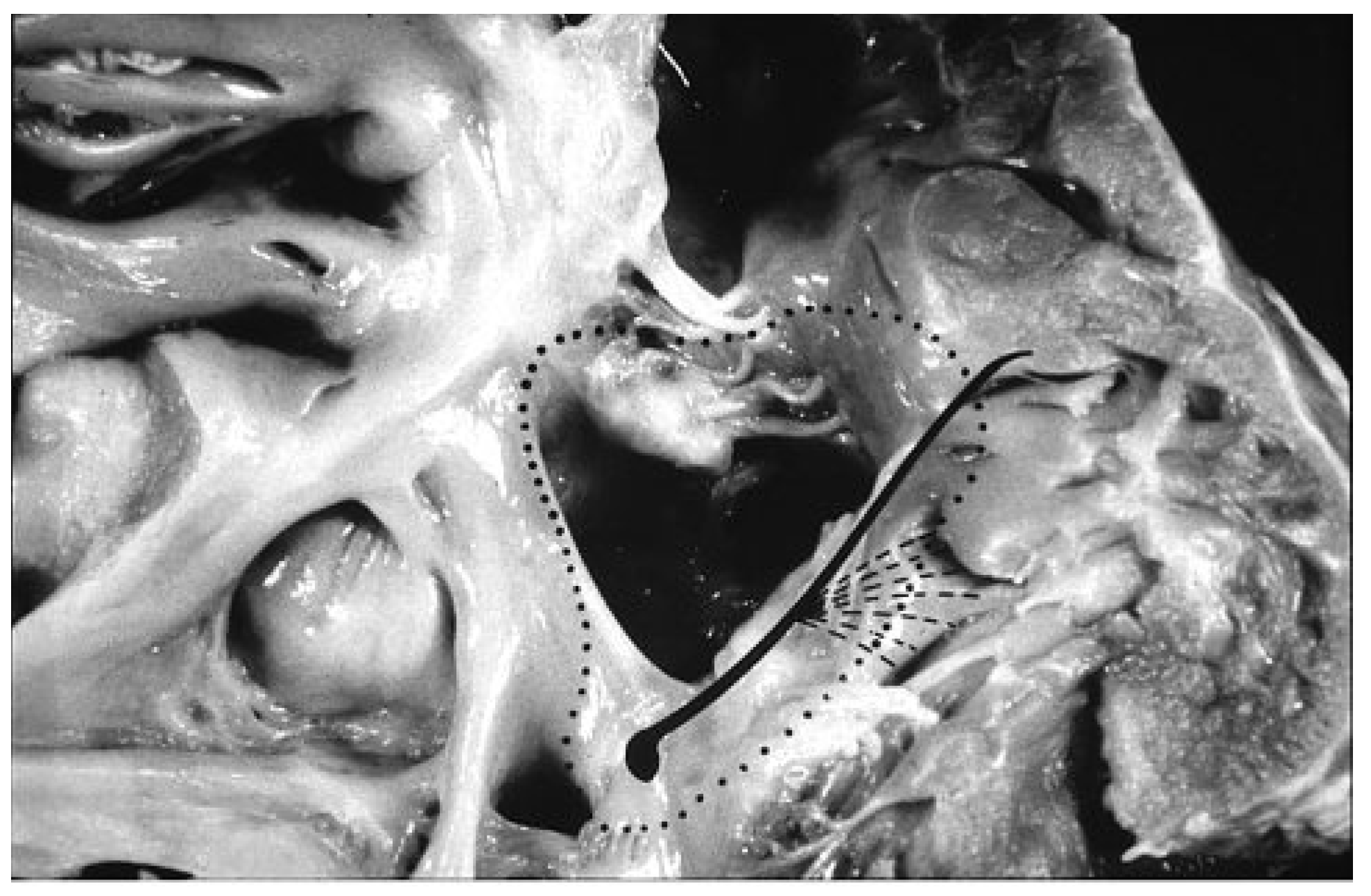 Cardiovascmed 13 00041 g003 Cardiovascmed 13 00041 g003