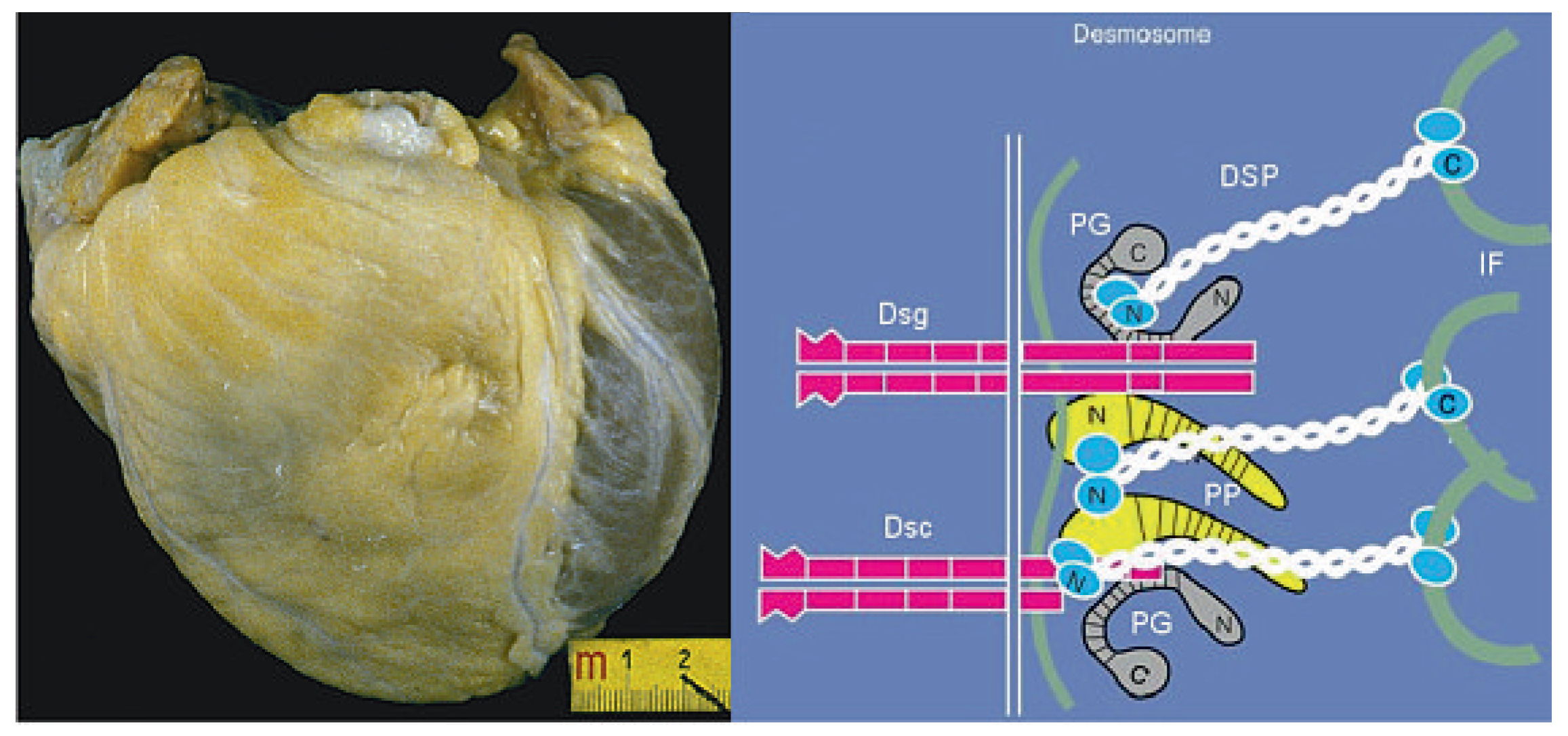 Cardiovascmed 13 00041 g006 Cardiovascmed 13 00041 g006