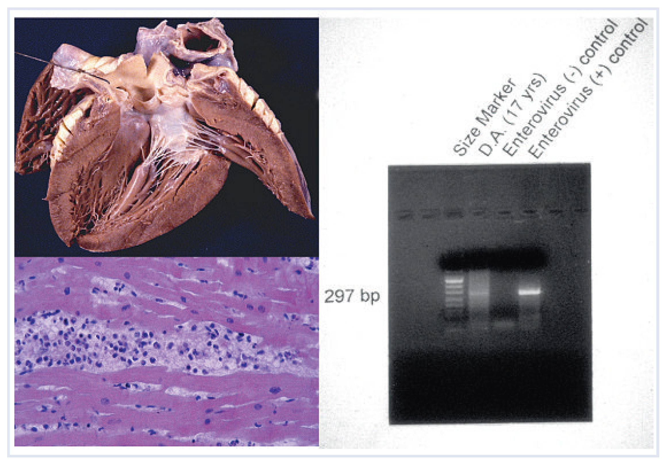Cardiovascmed 13 00041 g008 Cardiovascmed 13 00041 g008