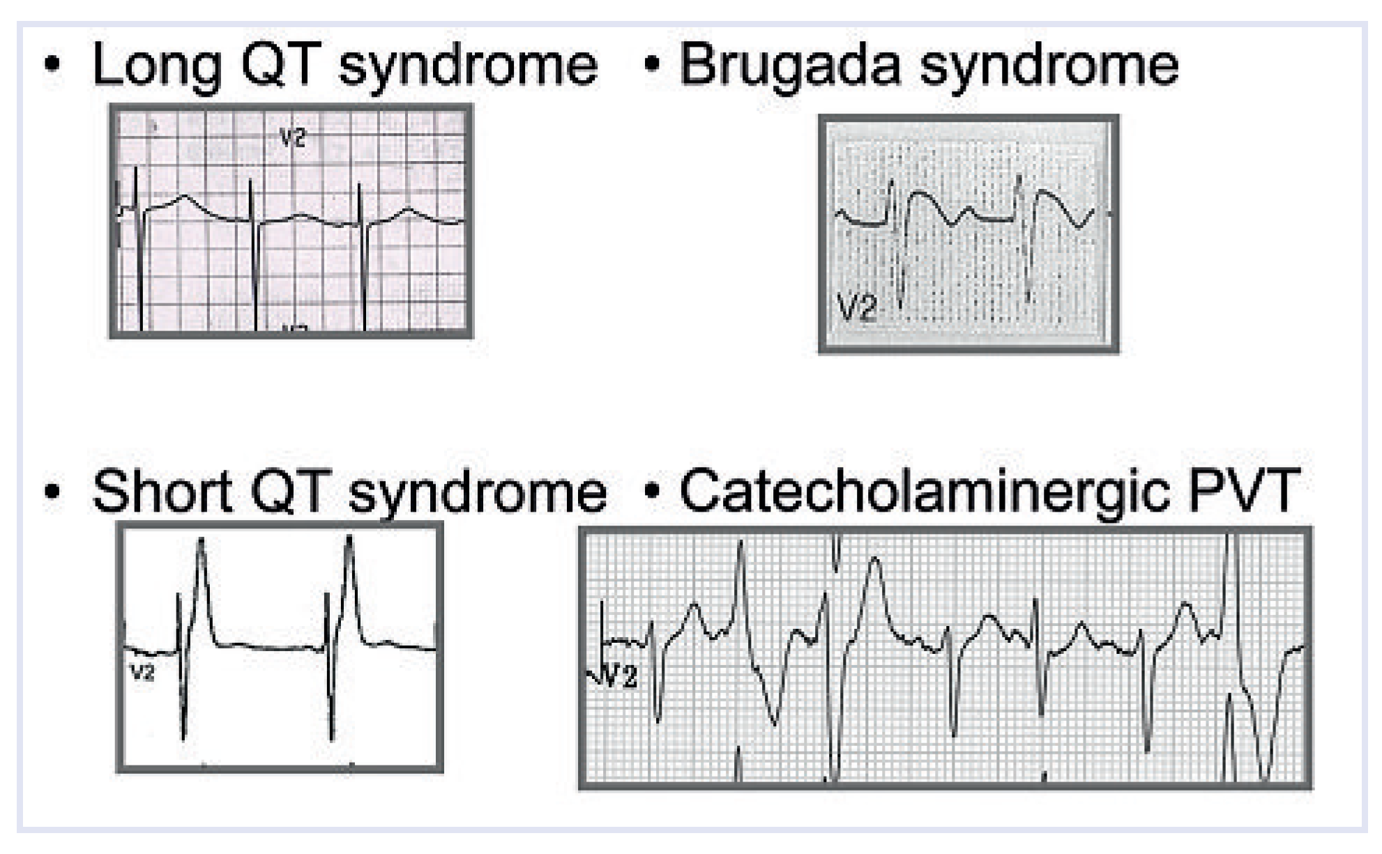 Cardiovascmed 13 00041 g009 Cardiovascmed 13 00041 g009