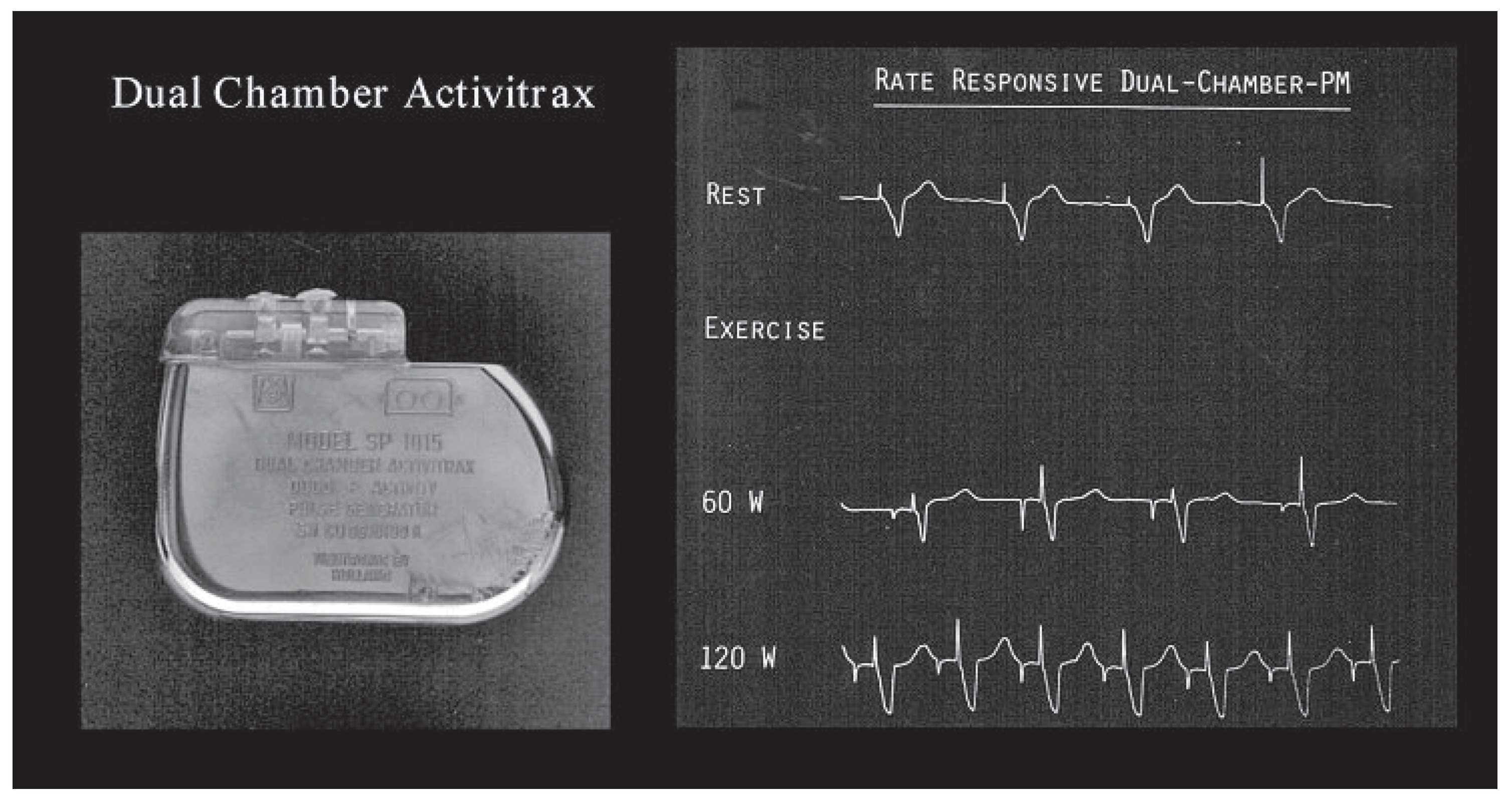 Cardiovascmed 13 00050 g003