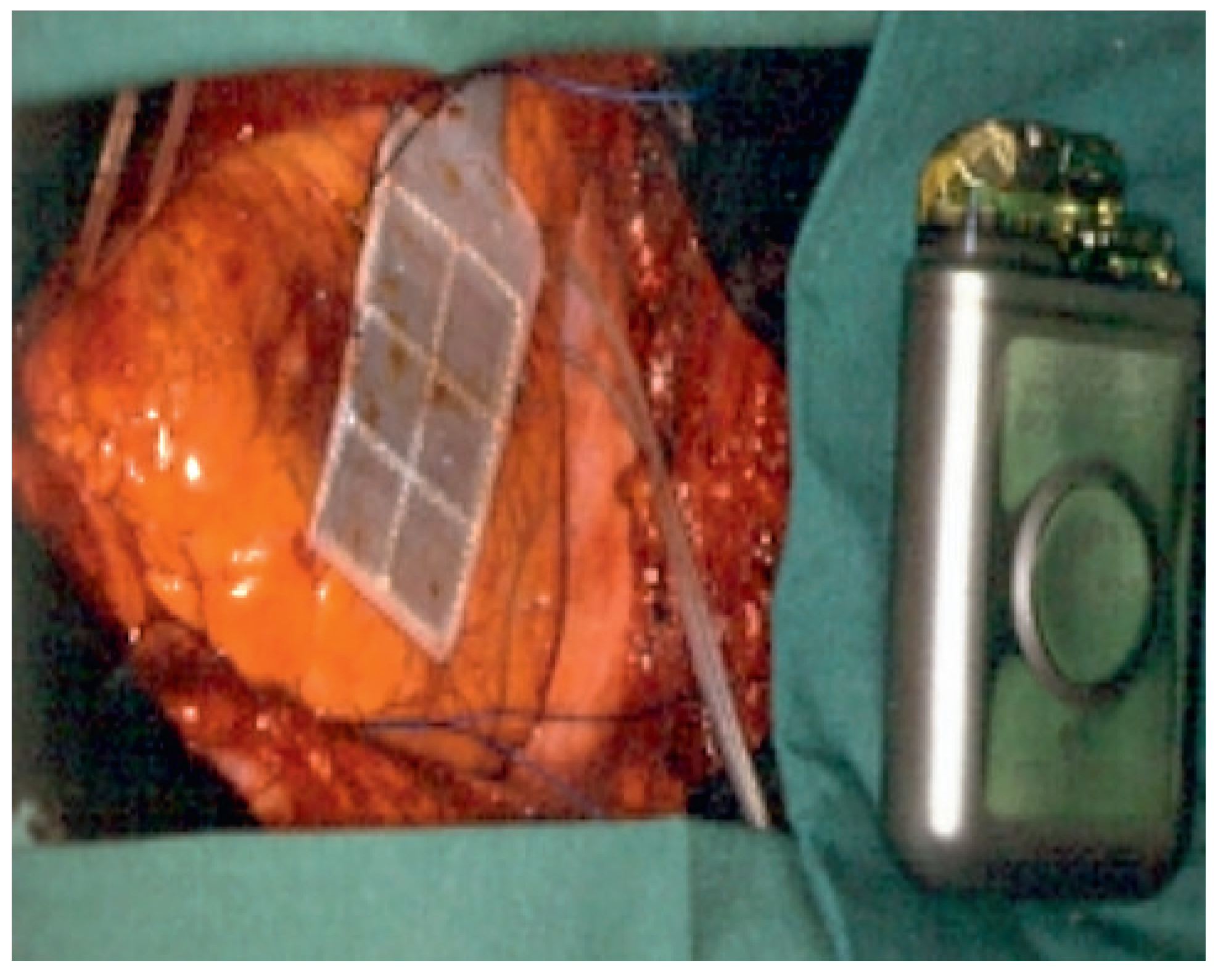 Cardiovascmed 13 00050 g004