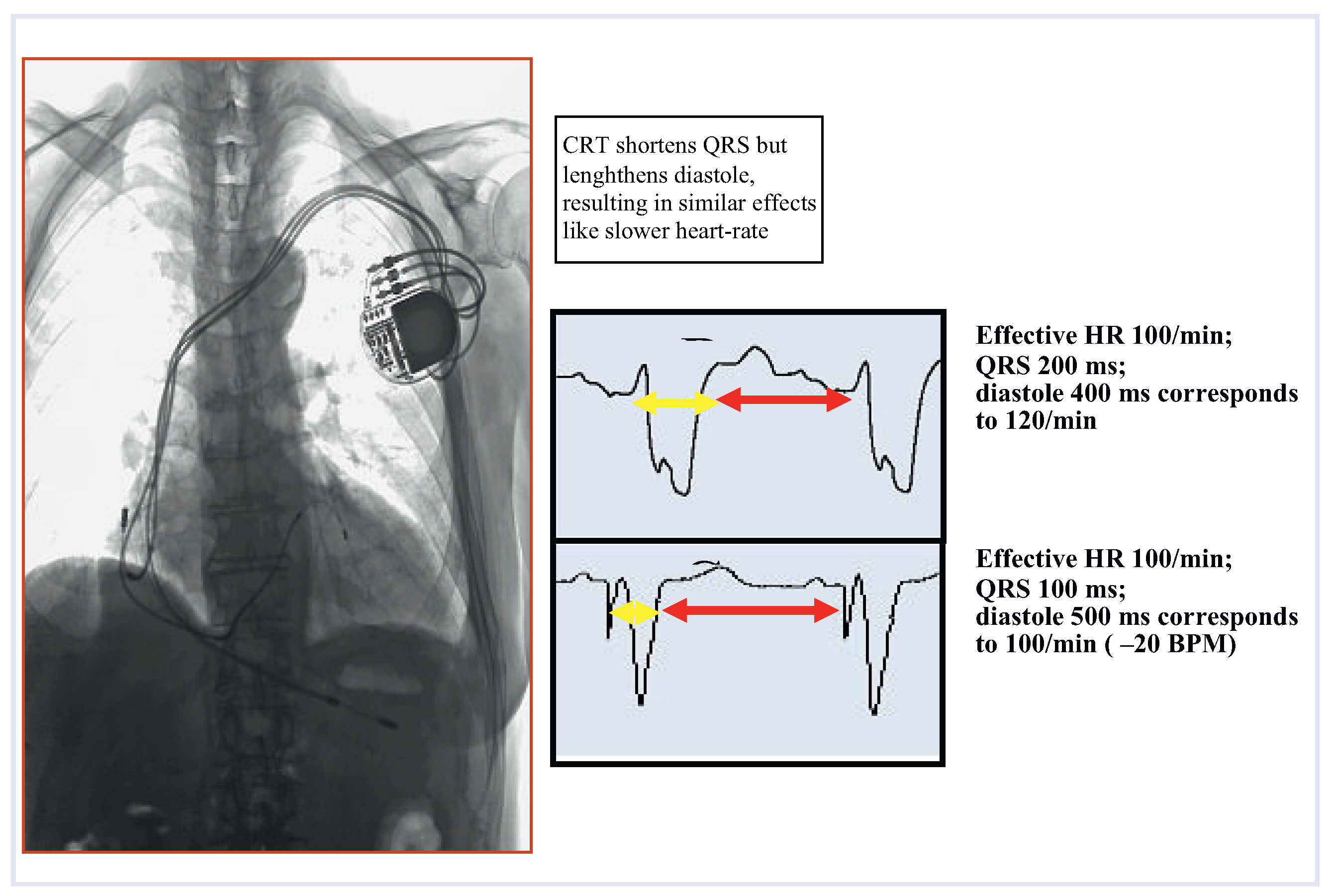 Cardiovascmed 13 00050 g005