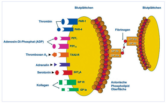 Cardiovascmed 13 00060 g001