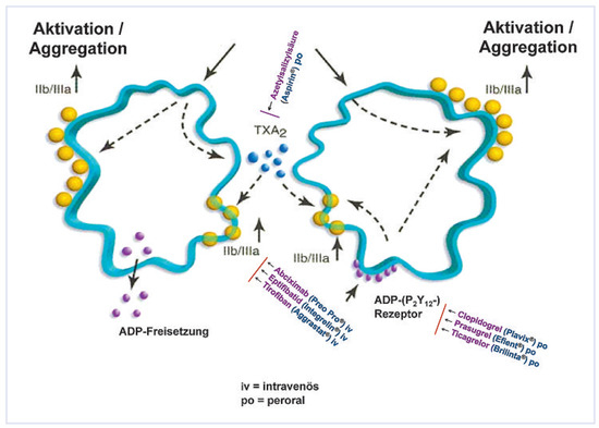 Cardiovascmed 13 00060 g002