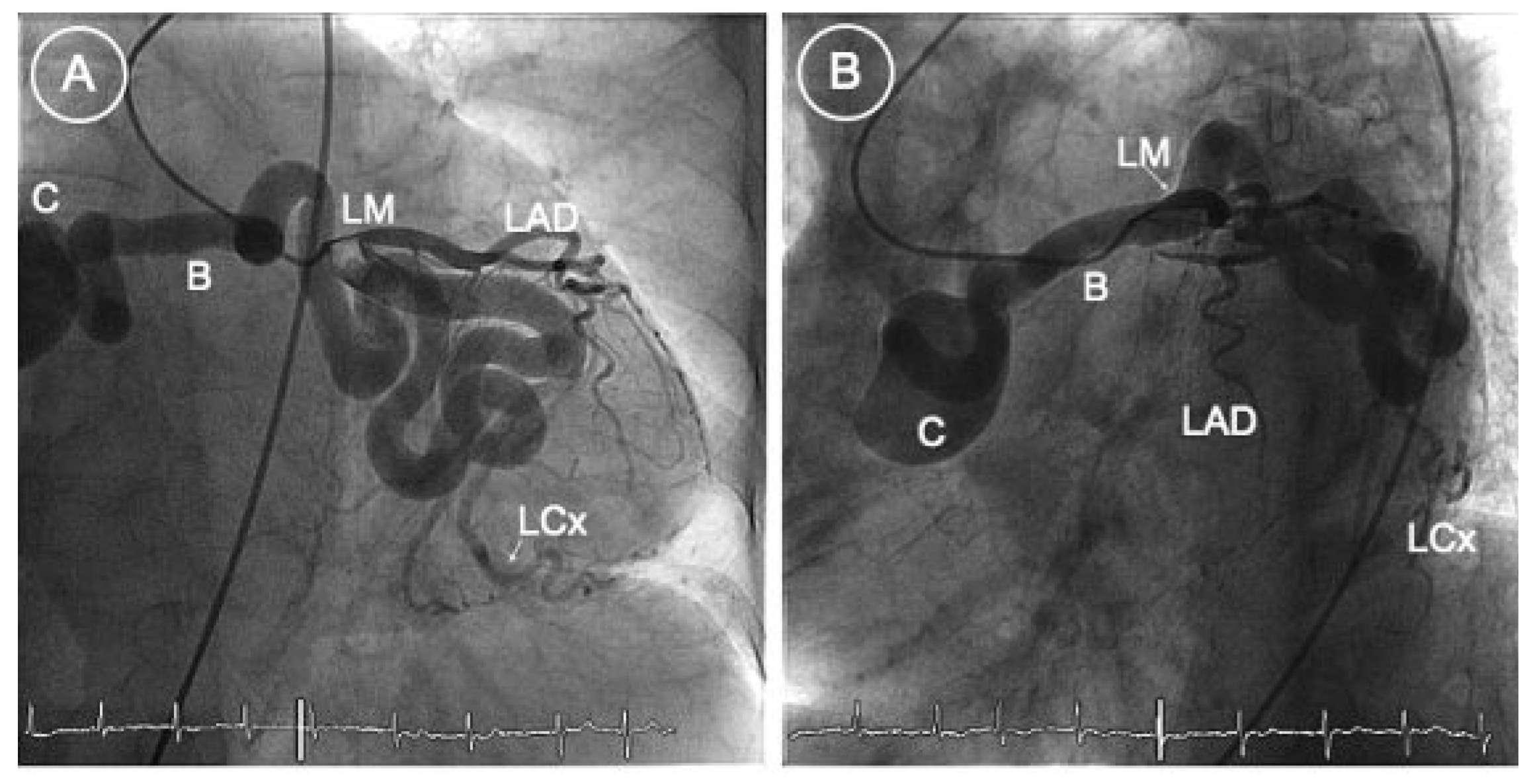 Cardiovascmed 13 00068 g001