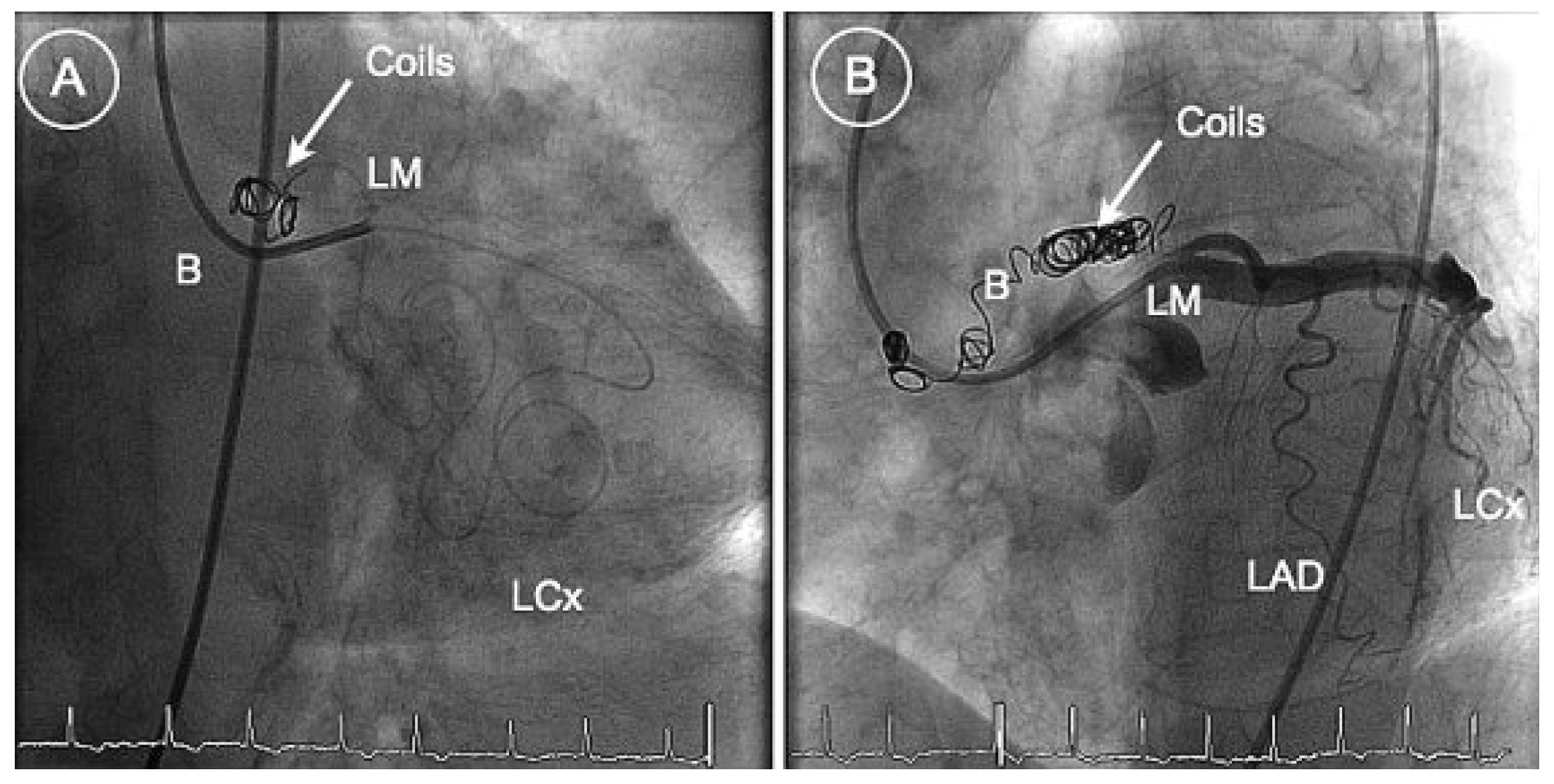 Cardiovascmed 13 00068 g002