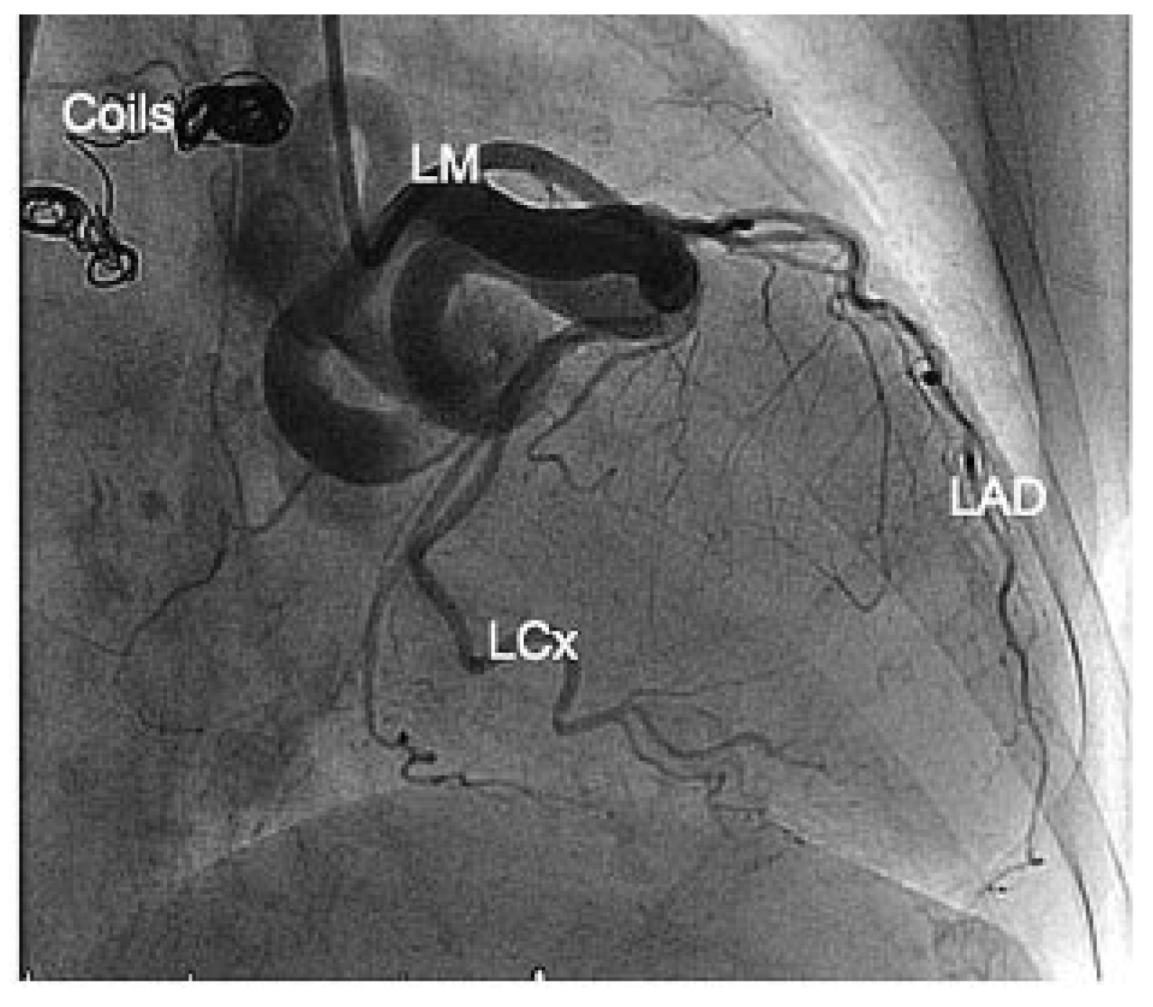 Cardiovascmed 13 00068 g003