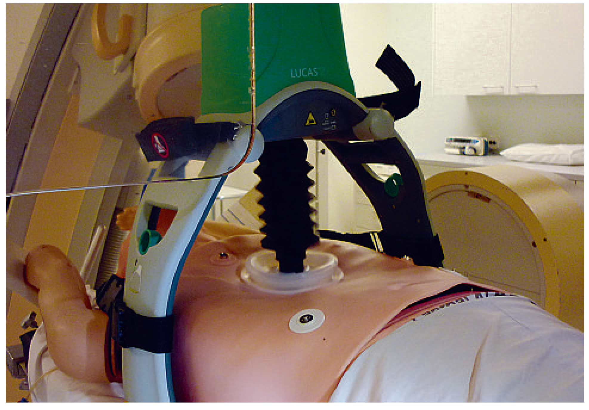 Cardiovascmed 13 00092 g002 Cardiovascmed 13 00092 g002