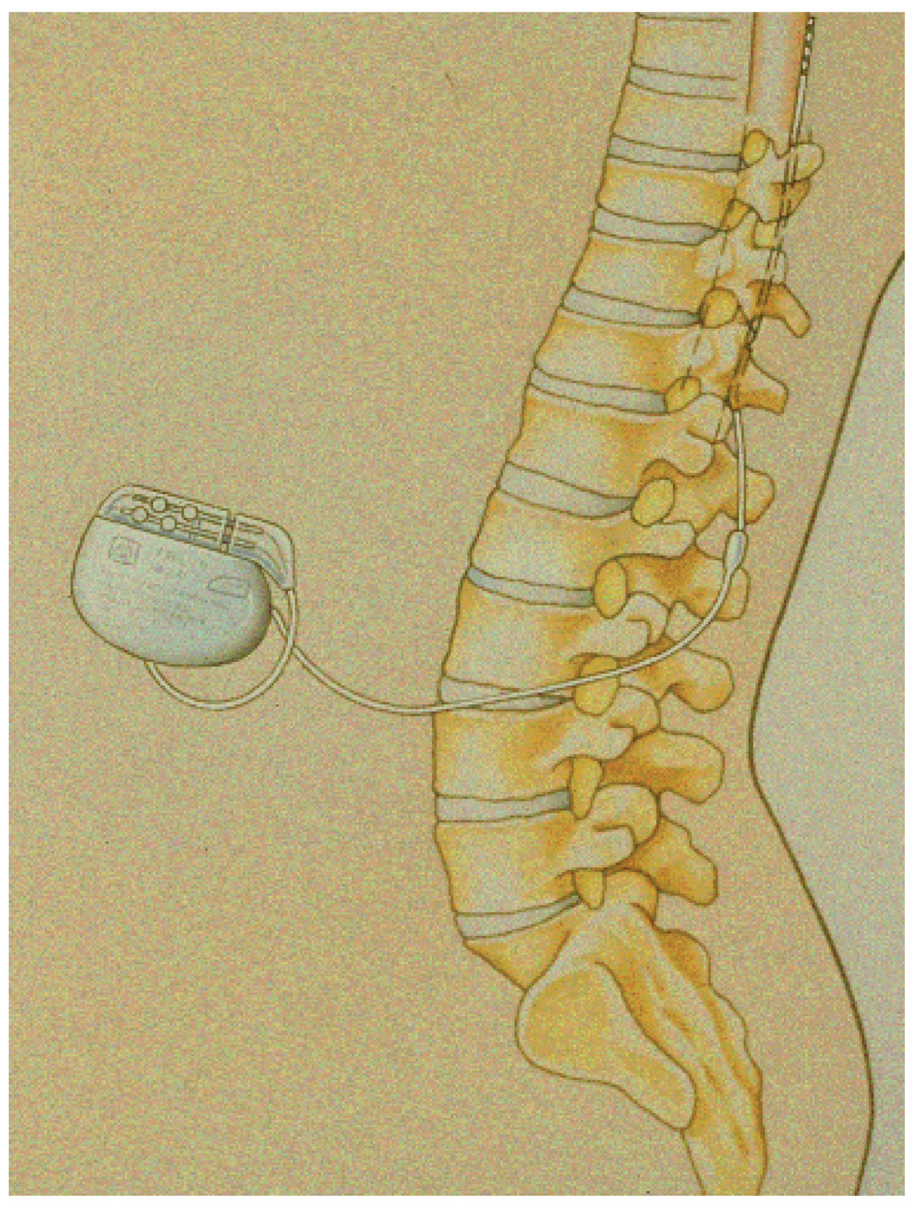 Cardiovascmed 13 00097 g001