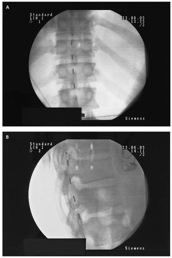 Cardiovascmed 13 00097 g003