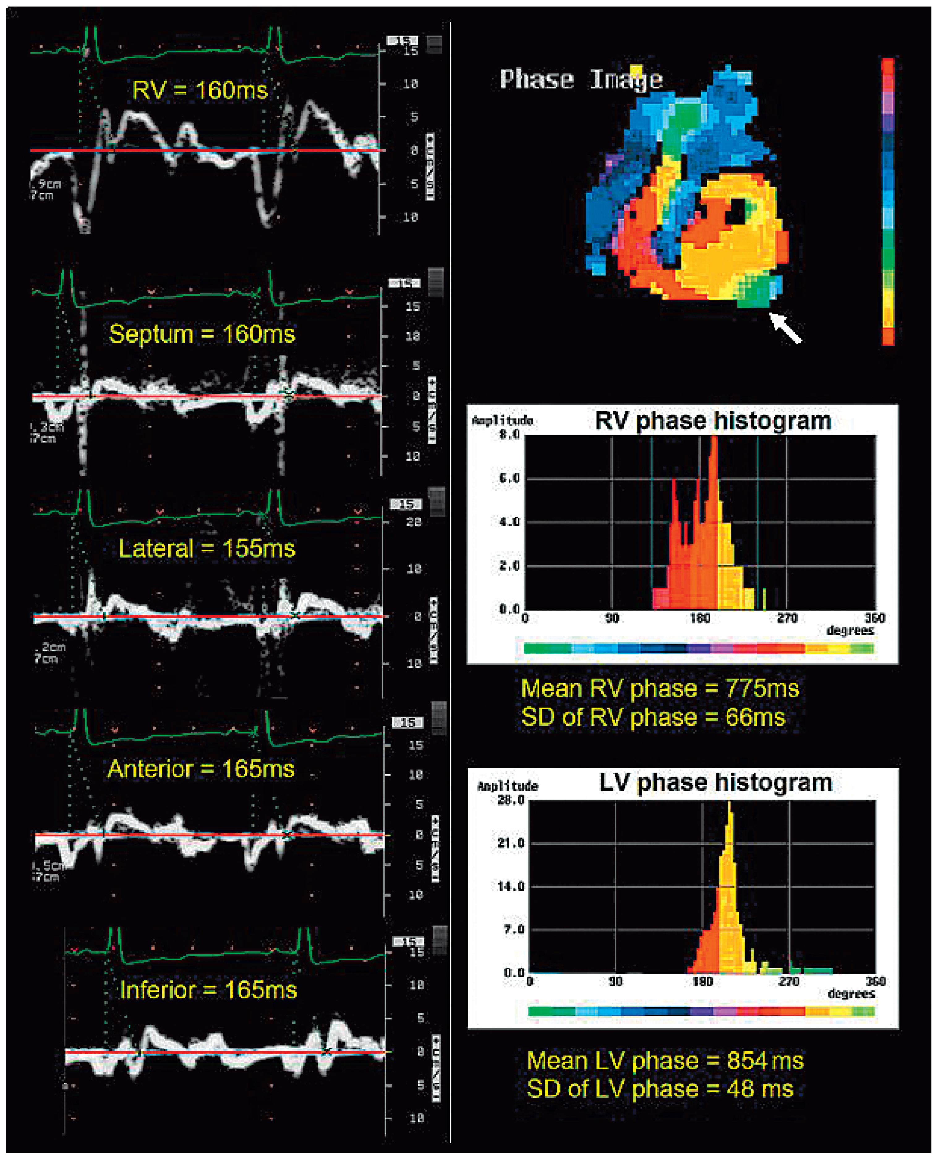 Cardiovascmed 13 00115 g003