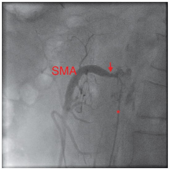 Cardiovascmed 13 00135 g001