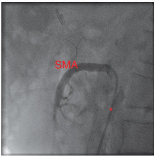 Cardiovascmed 13 00135 g002