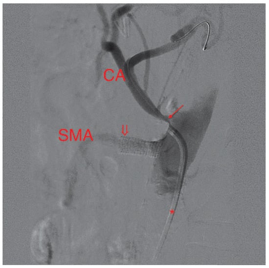 Cardiovascmed 13 00135 g003