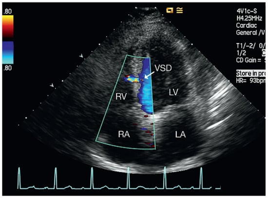 Cardiovascmed 13 00167 g001