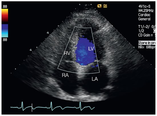 Cardiovascmed 13 00167 g002