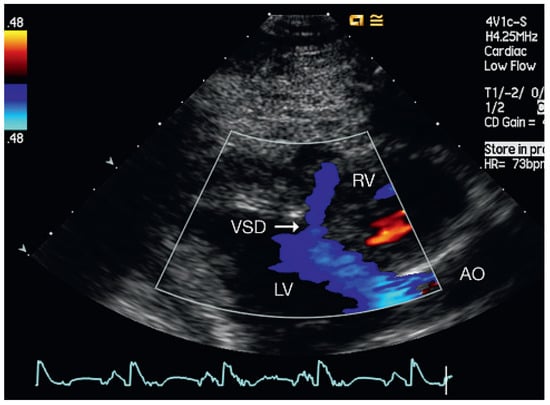 Cardiovascmed 13 00167 g006