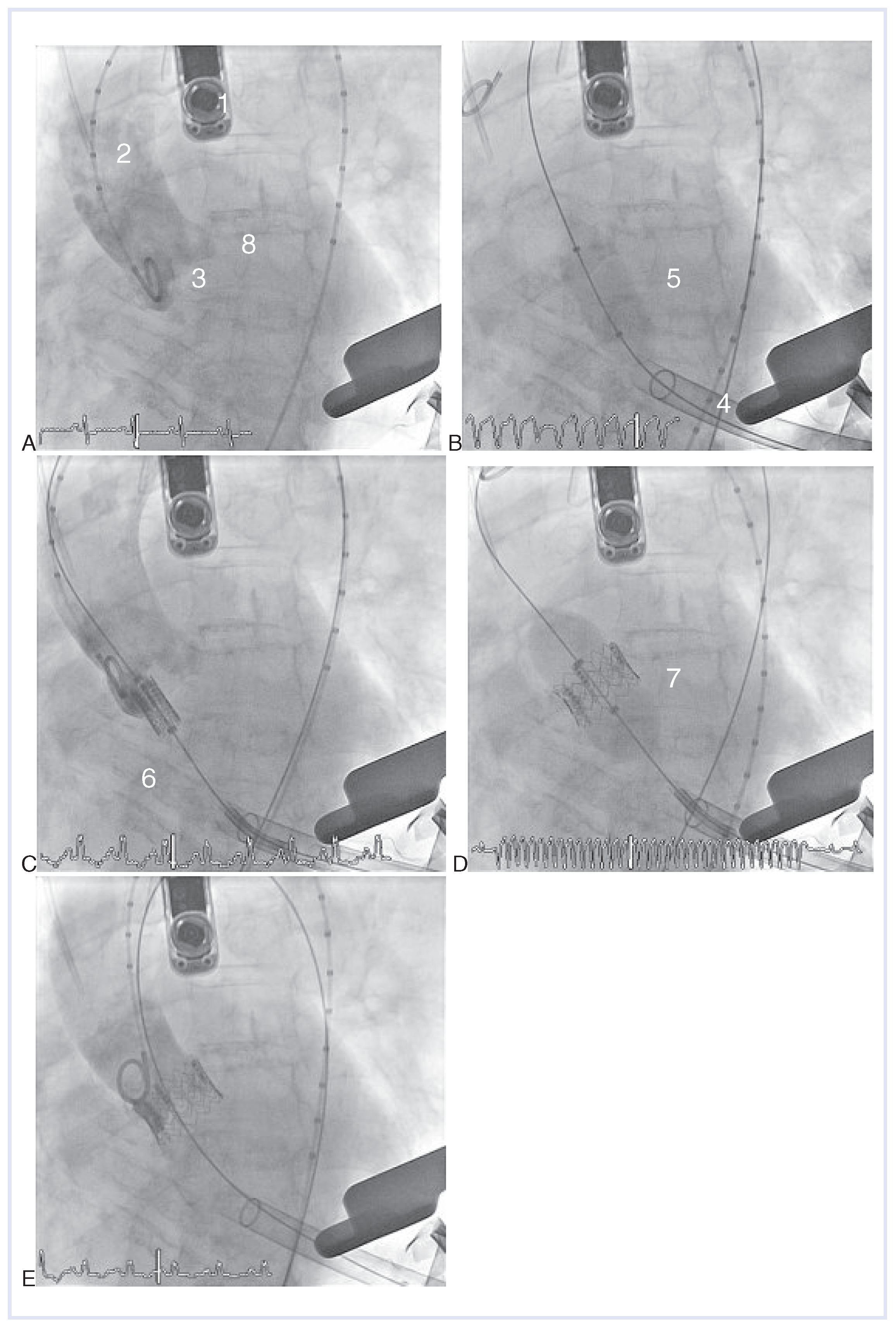 Cardiovascmed 13 00197 g003 Cardiovascmed 13 00197 g003