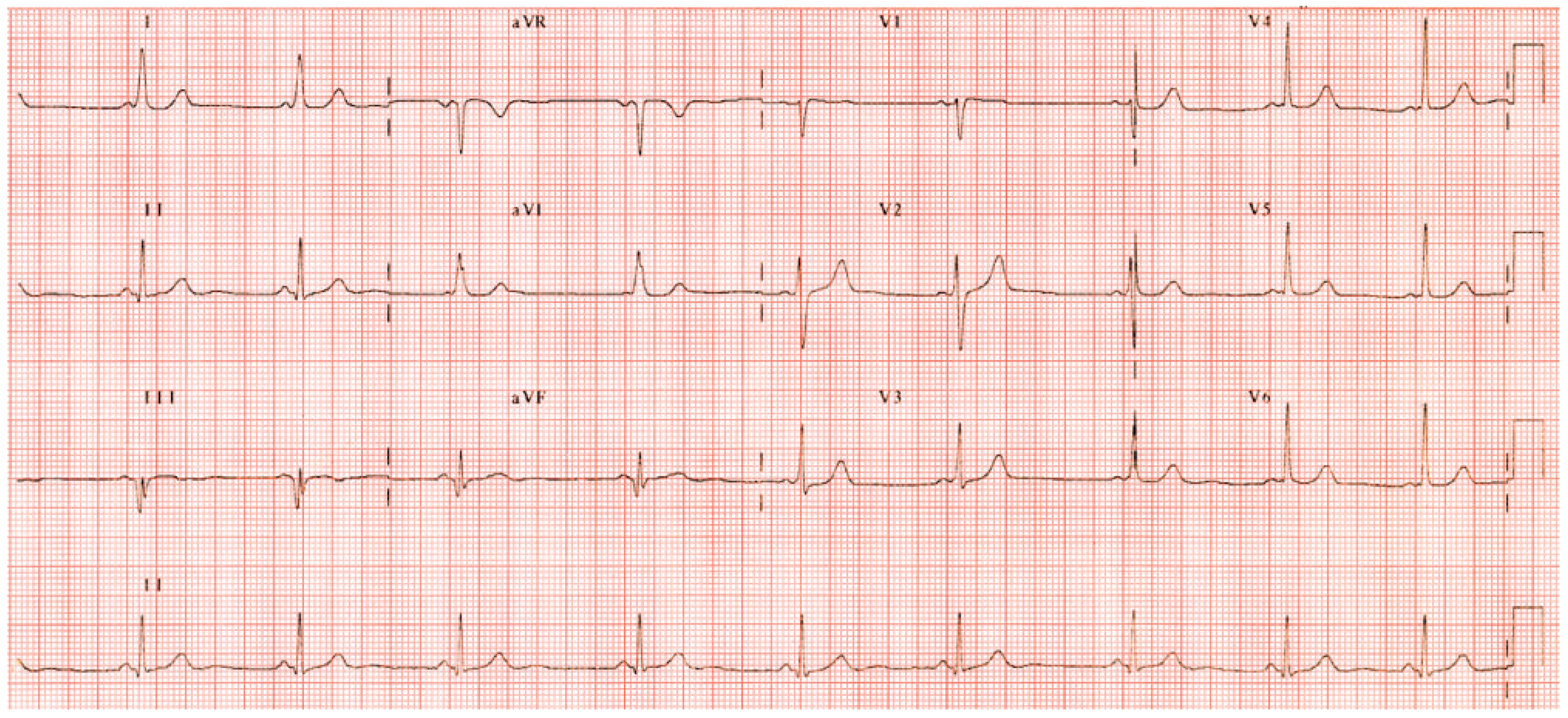 Cardiovascmed 13 00243 g001 Cardiovascmed 13 00243 g001