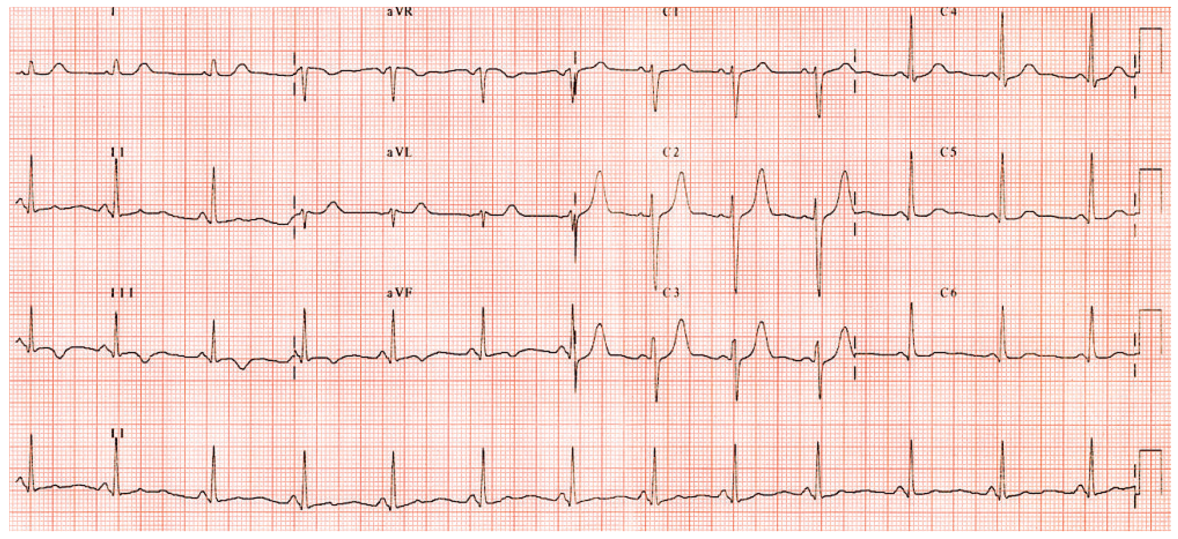 Cardiovascmed 13 00243 g002 Cardiovascmed 13 00243 g002
