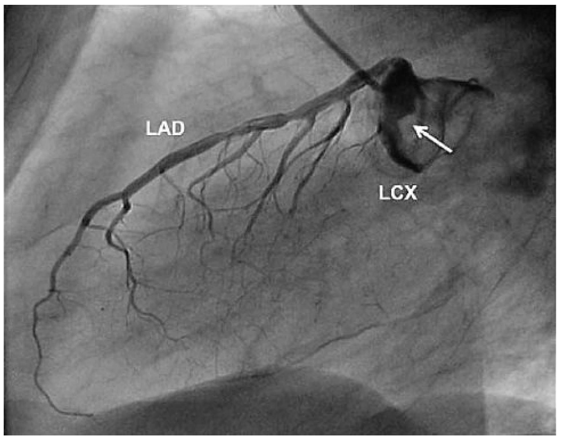 Cardiovascmed 13 00247 g002