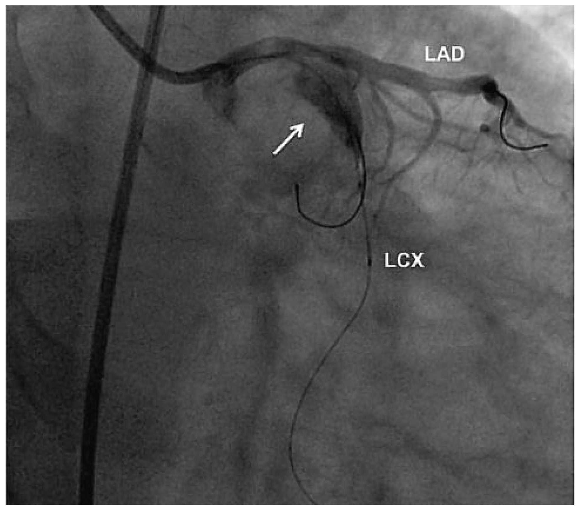Cardiovascmed 13 00247 g003
