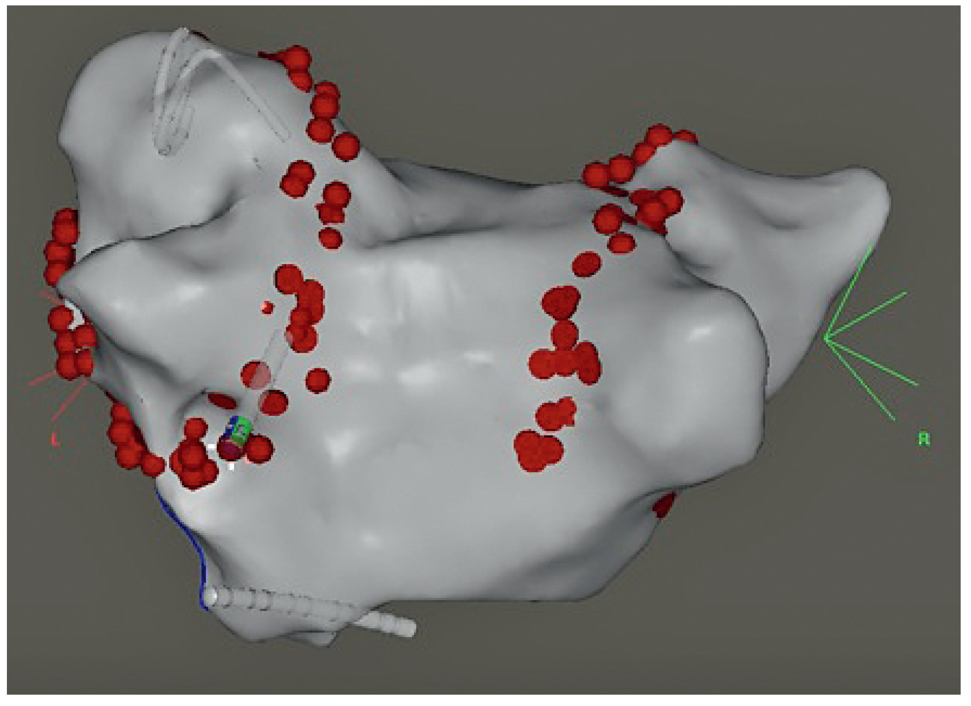 Cardiovascmed 13 00272 g006 Cardiovascmed 13 00272 g006