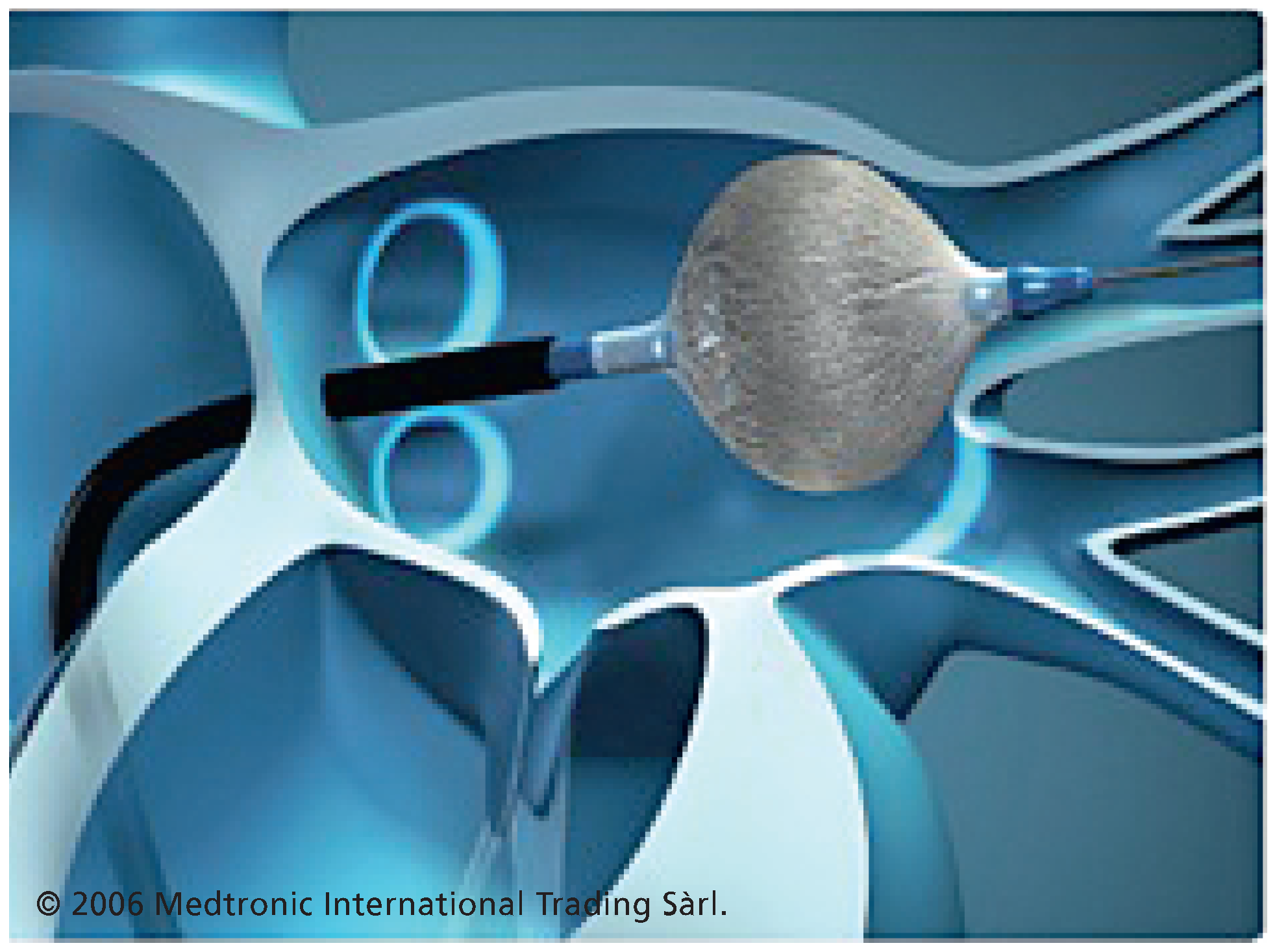 Cardiovascmed 13 00272 g011 Cardiovascmed 13 00272 g011